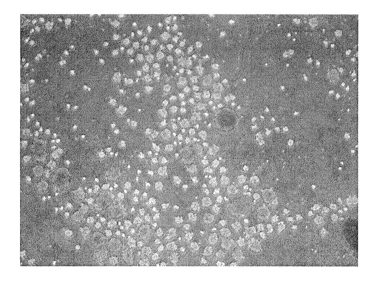 Method for producing therapeutic corneal endothelial substitute cell sphere