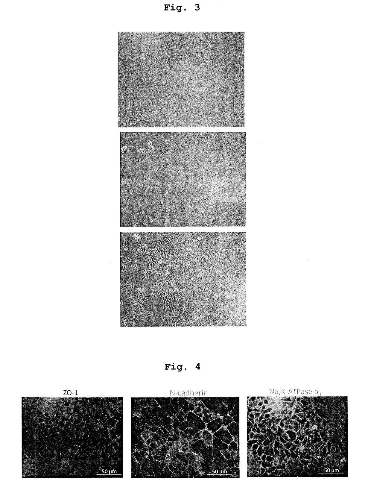 Method for producing therapeutic corneal endothelial substitute cell sphere