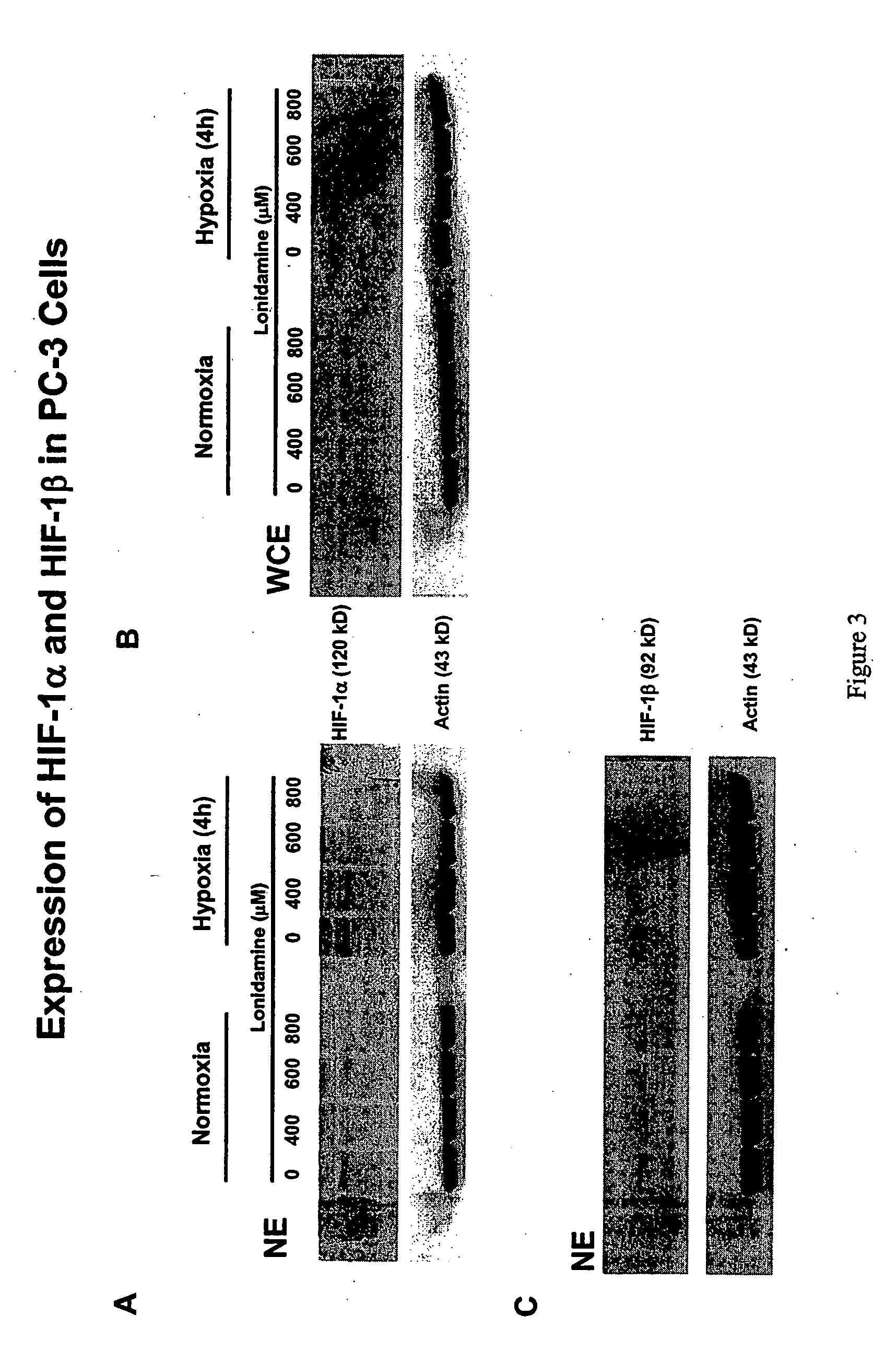 Prevention and treatment of benign prostatic hyperplasia using lonidamine and lonidamine analogs