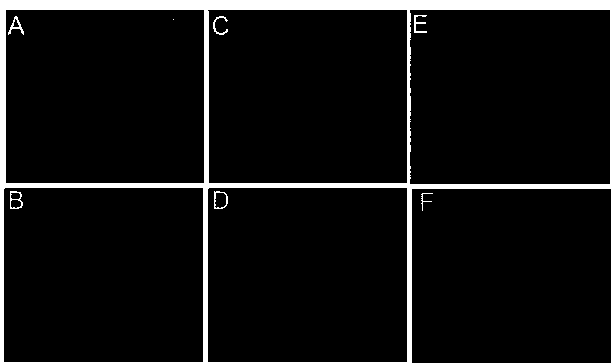 Myristic acid-mediated brain-targeting polymer micelle drug-delivery system and its preparation method and use