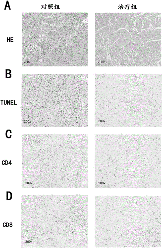 Mir-29 and application of inhibitor thereof in preparing medicine resisting organ transplant rejection