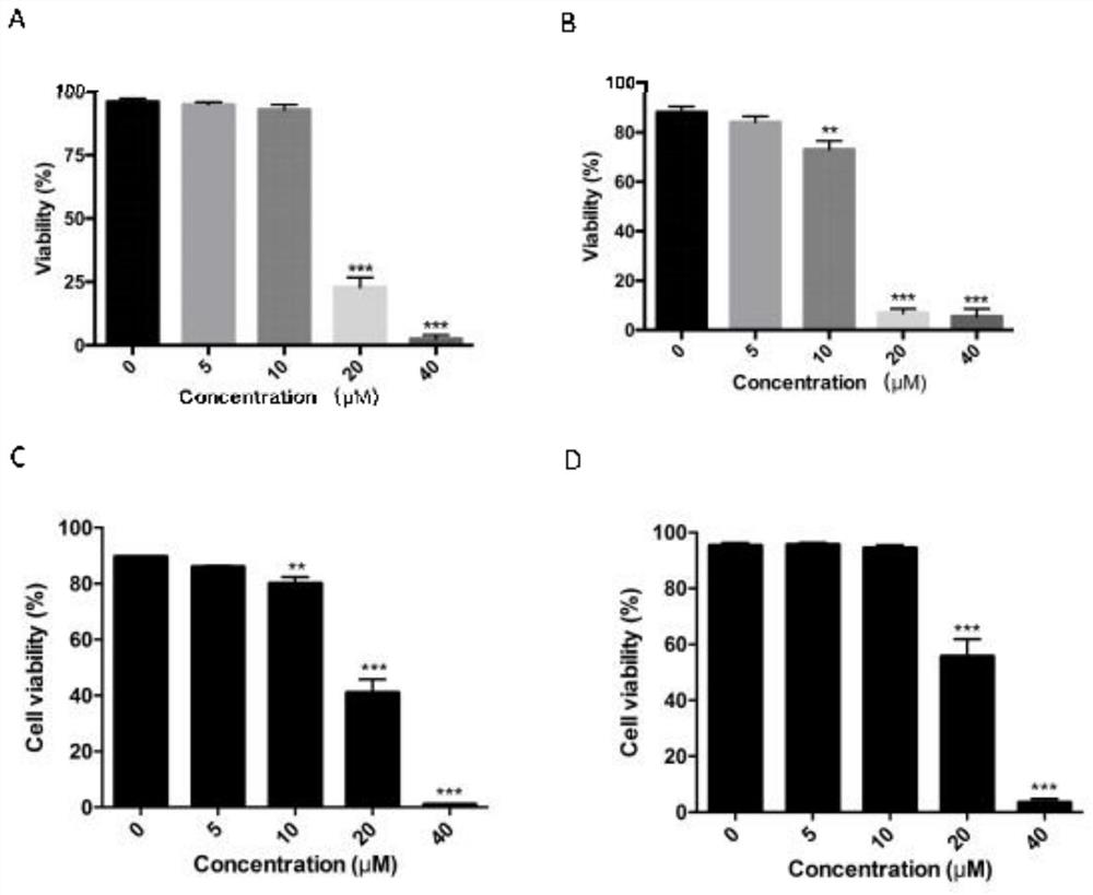 Application of an antimalarial drug primaquine phosphate in the preparation of a drug for treating leukemia