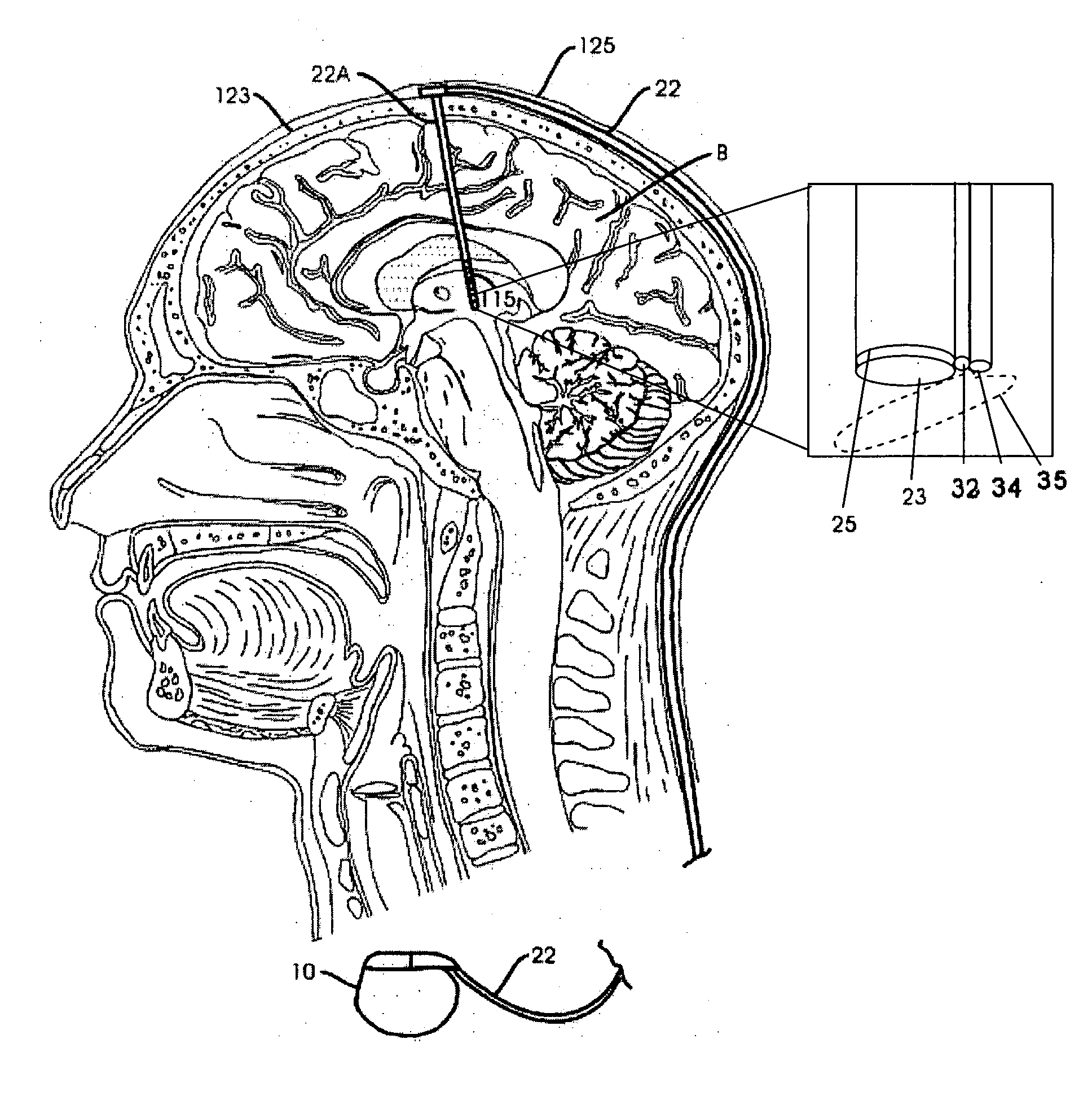 Applications of the stimulation of neural tissue using light