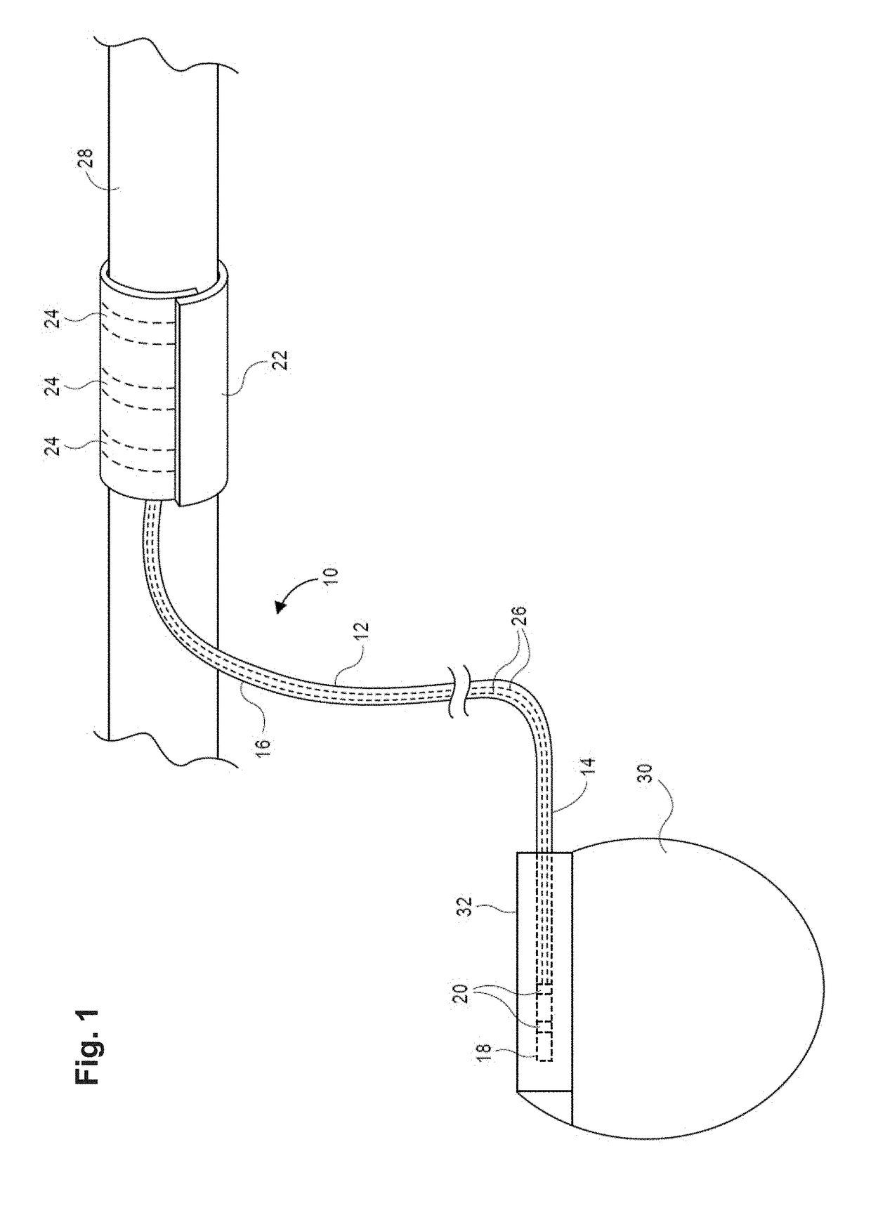 Nerve cuff electrodes fabricated using over-molded lcp substrates