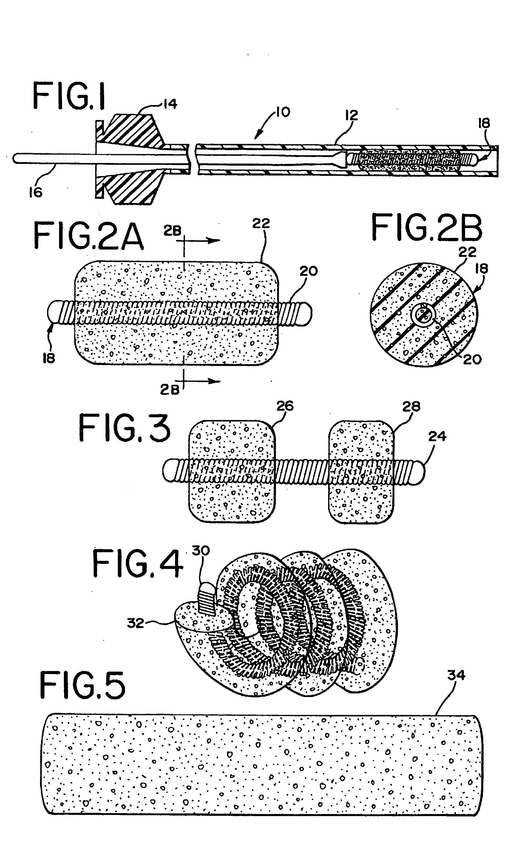 Foam matrix embolization device