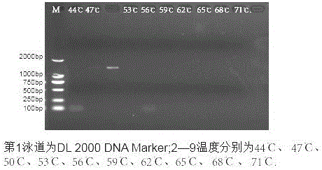 Trichomonad nested PCR detection kit and preparation method