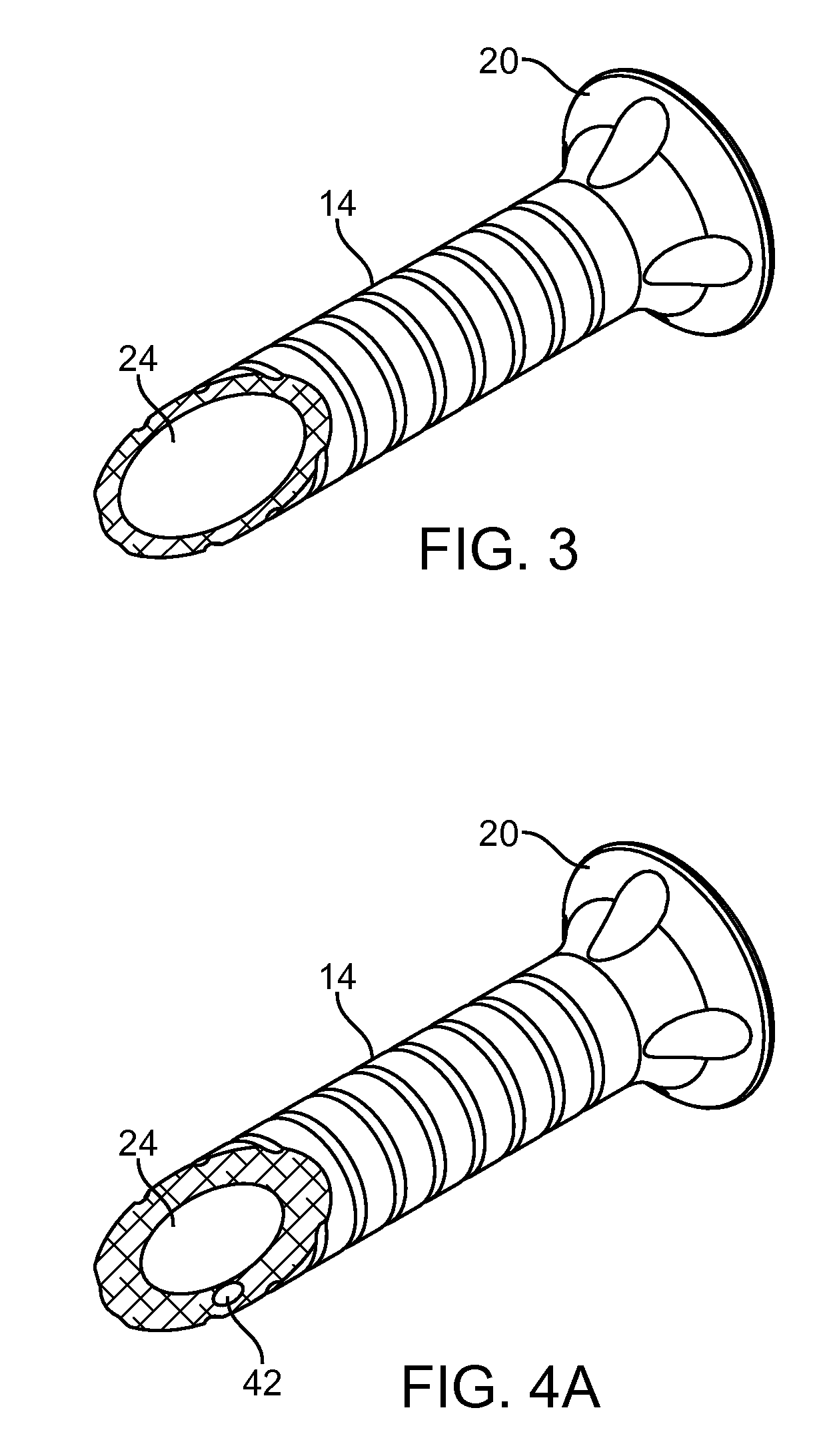 Illuminated and modular soft tissue retractor