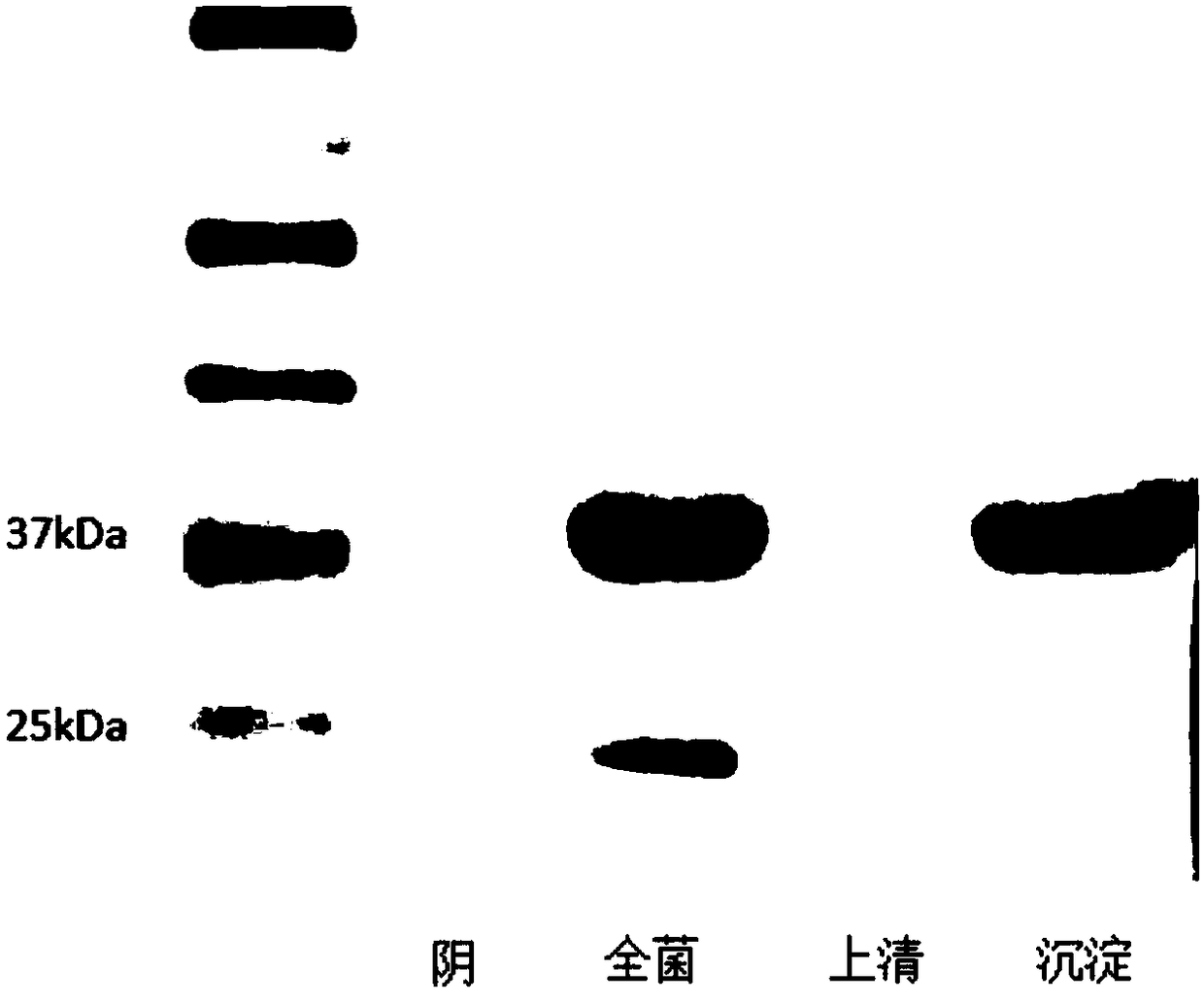 Method for expressing truncated non-structural protein NS4B of Tembusu virus and product and application thereof