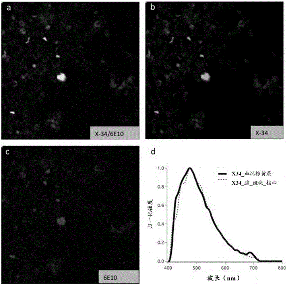 Methods for analyzing blood to detect diseases associated with abnormal protein aggregation