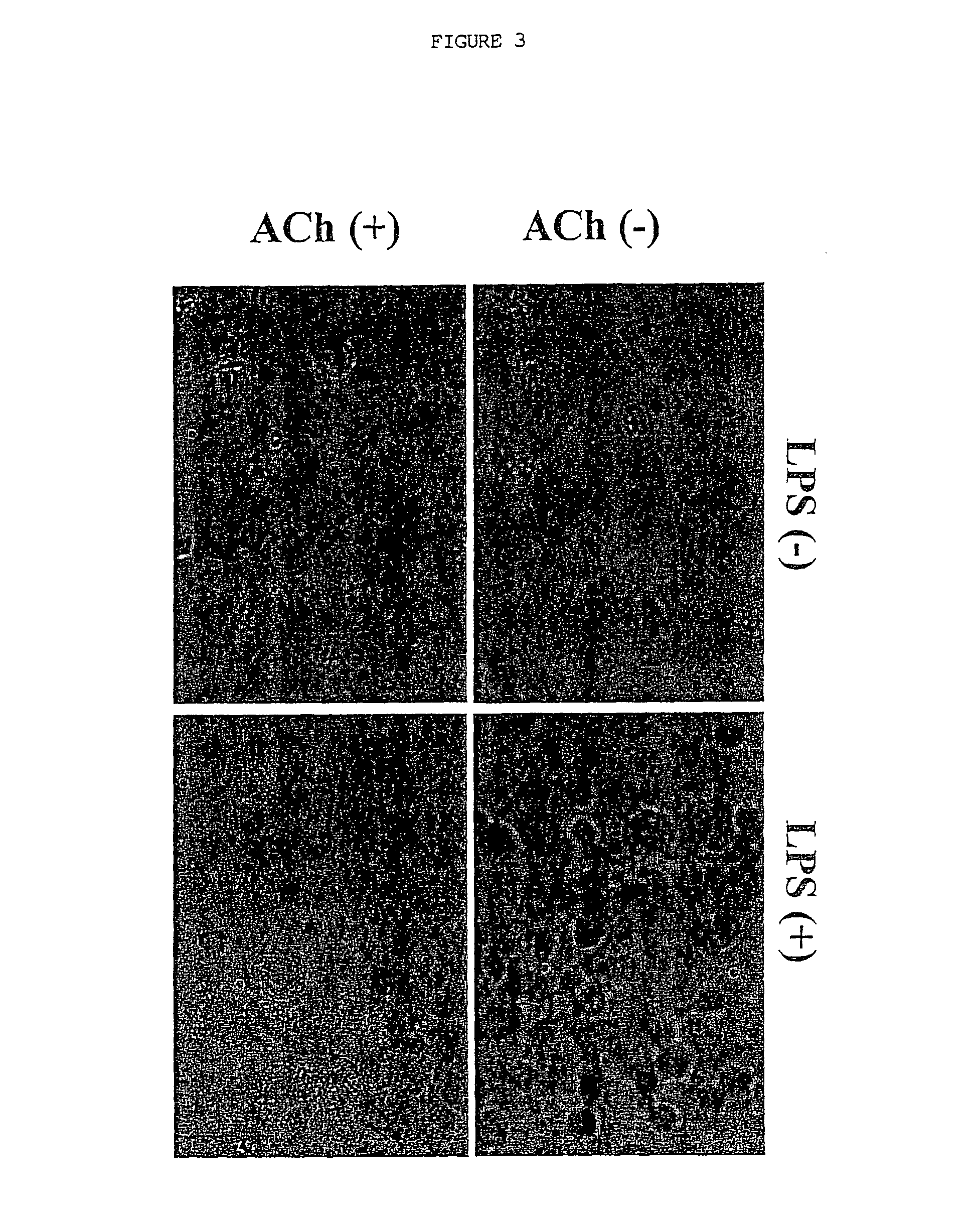 Inhibition of inflammatory cytokine production by cholinergic agonists and vagus nerve stimulation