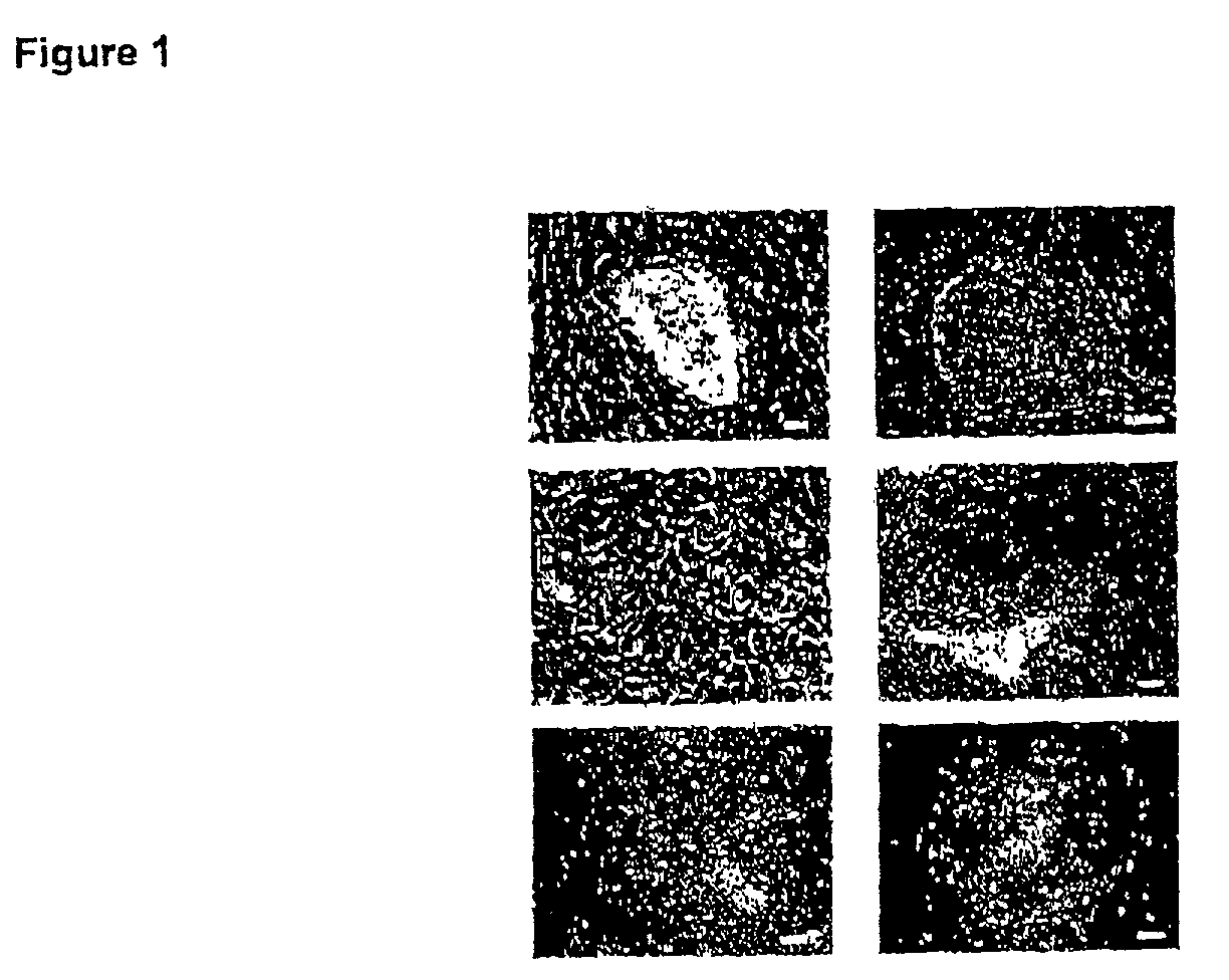 Implanting neural progenitor cells derived for human embryonic stem cells