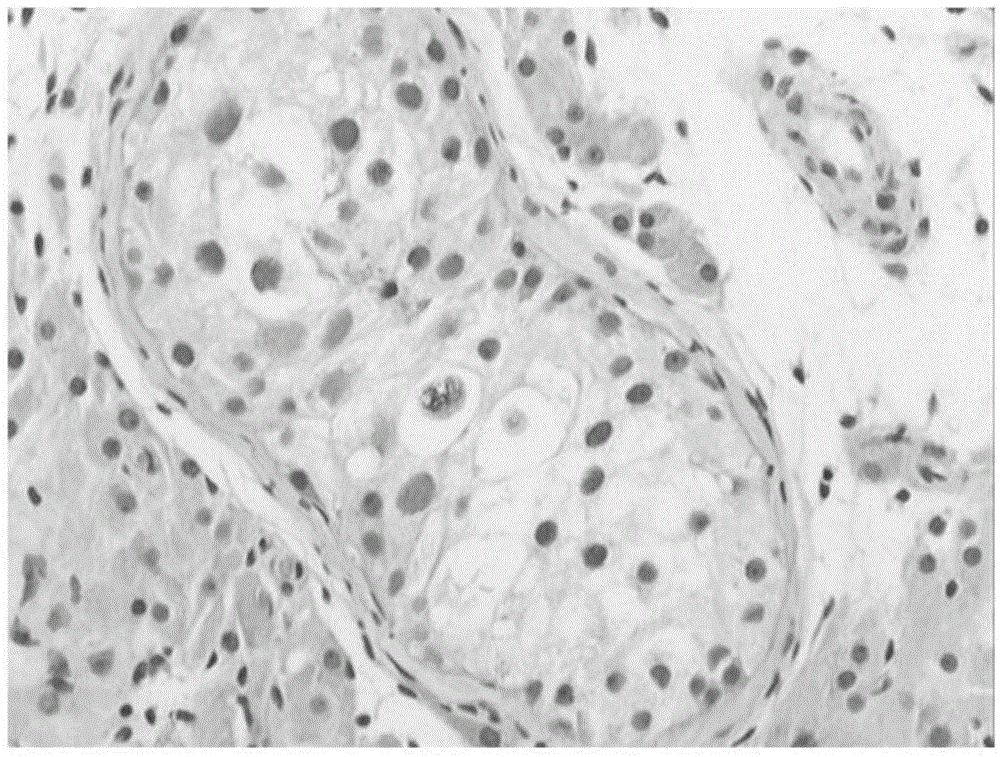 Primer pair for detecting genetic marker relevant to male infertility