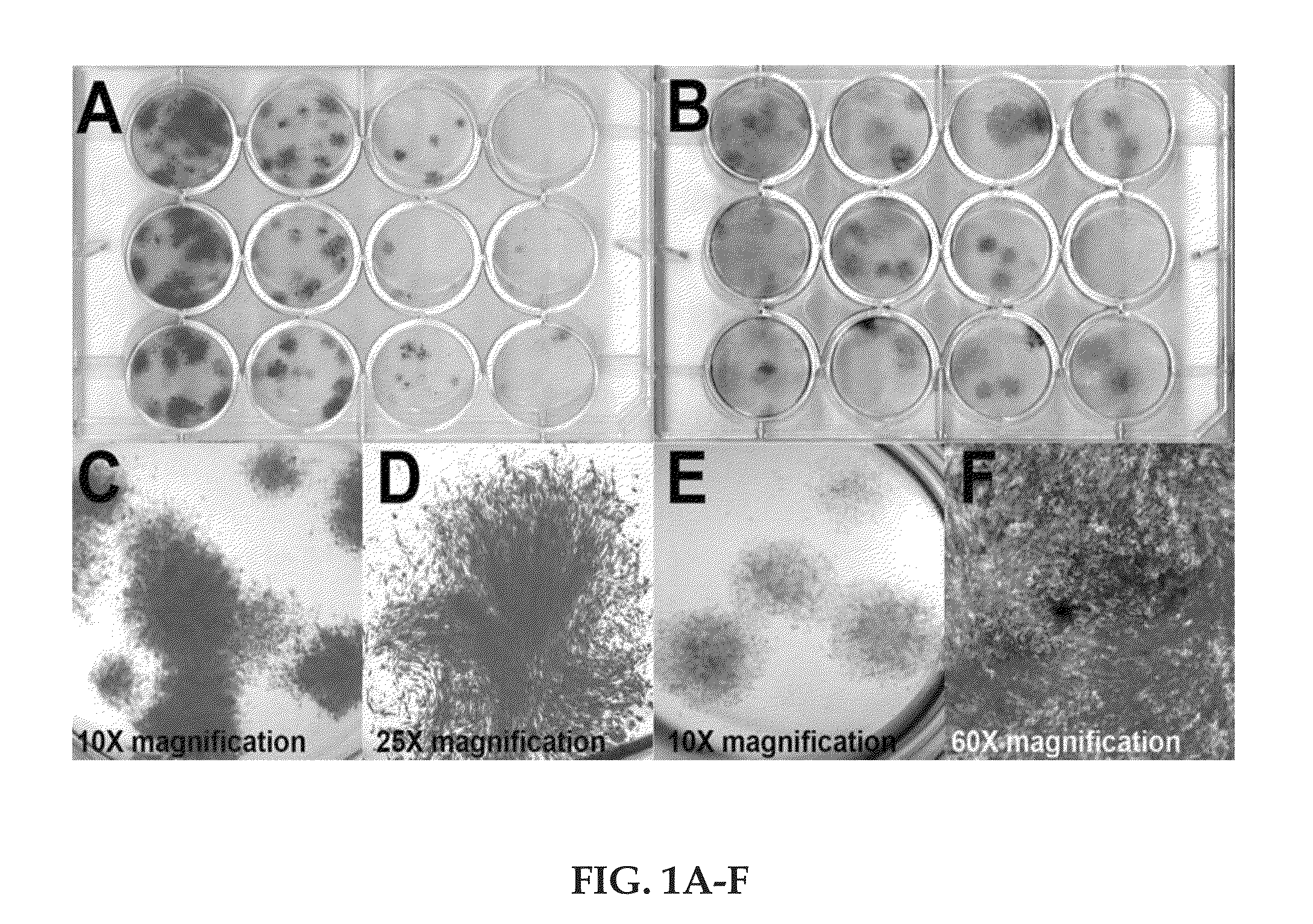 Regenerative autologous bone marrow cell therapies and methods for their use in the treatment of joint pain