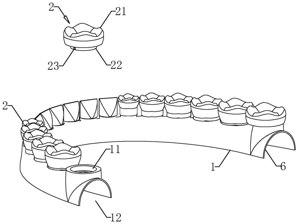 Removable denture