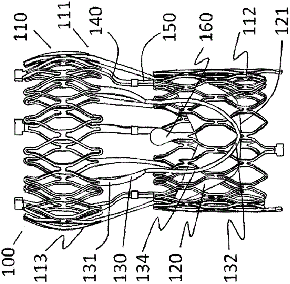 Artificial valve prosthesis with leaflet clamping device