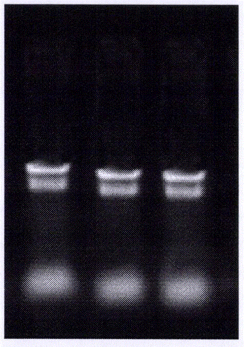 Gene cloning method, expressing method and application of psychrophilic yeast metallothionein