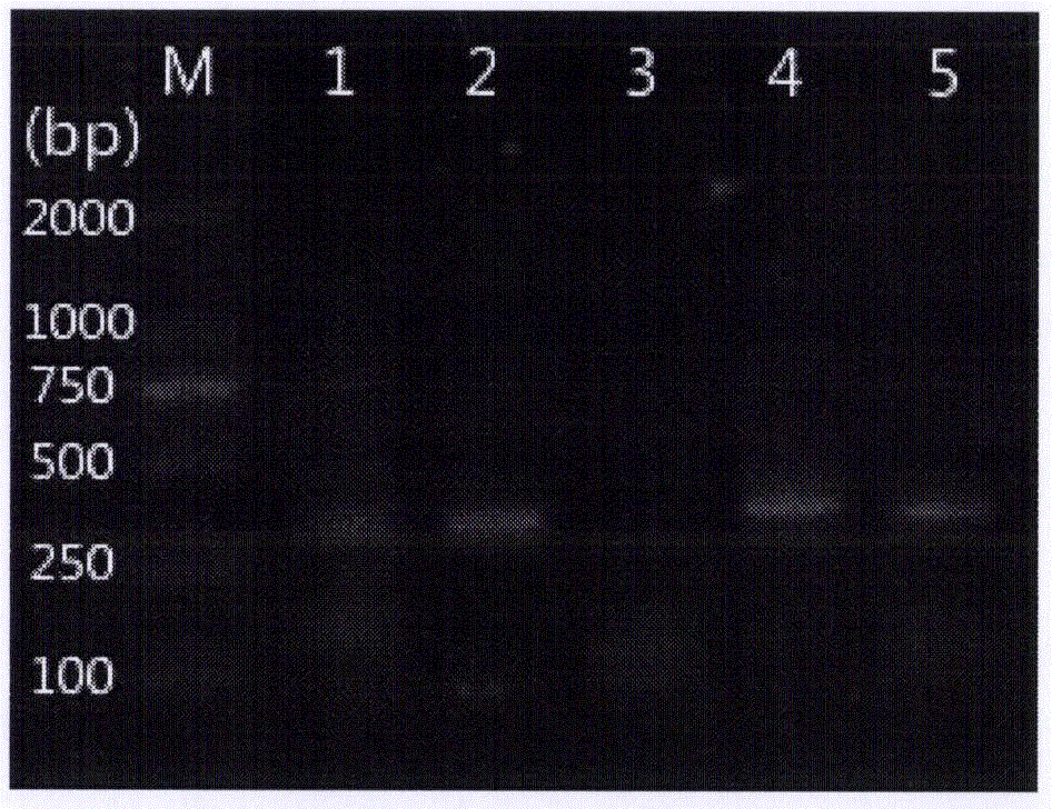 Gene cloning method, expressing method and application of psychrophilic yeast metallothionein