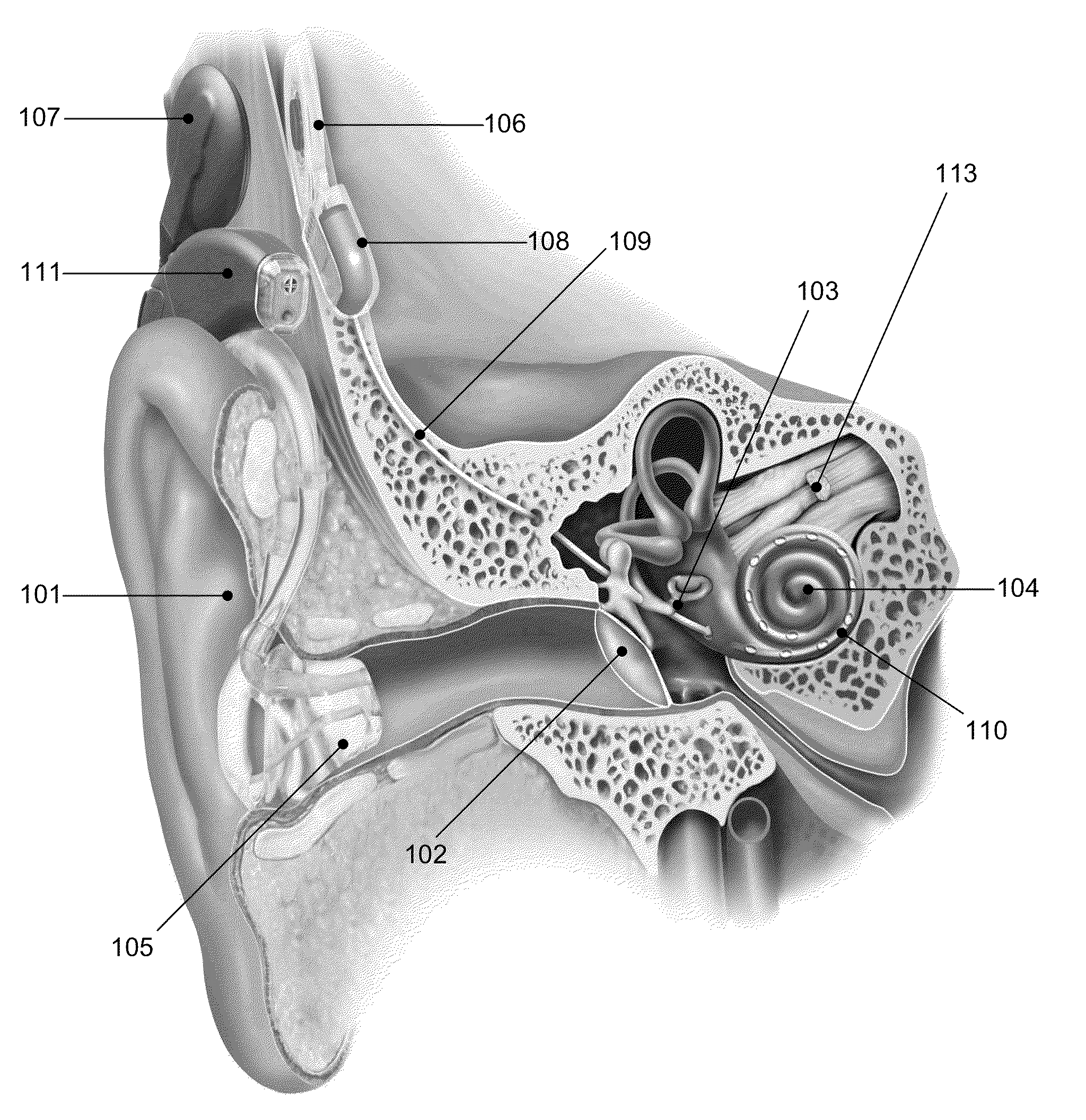 Low Pulse Rate Cochlear Implant Stimulation In Conjunction With A Separate Representation Of Fundamental Frequencies And Voiced/Unvoiced Distinctions