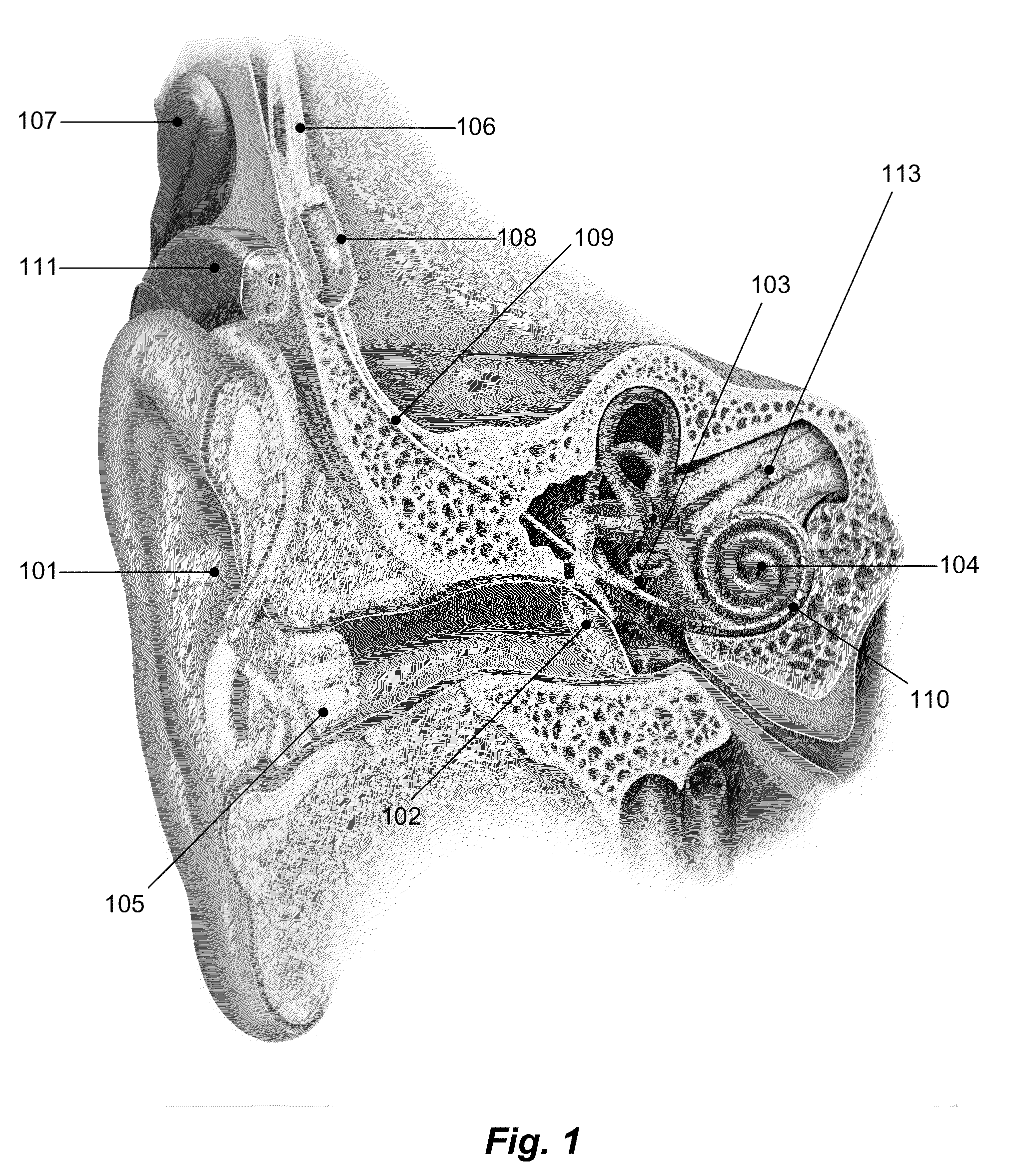 Low Pulse Rate Cochlear Implant Stimulation In Conjunction With A Separate Representation Of Fundamental Frequencies And Voiced/Unvoiced Distinctions