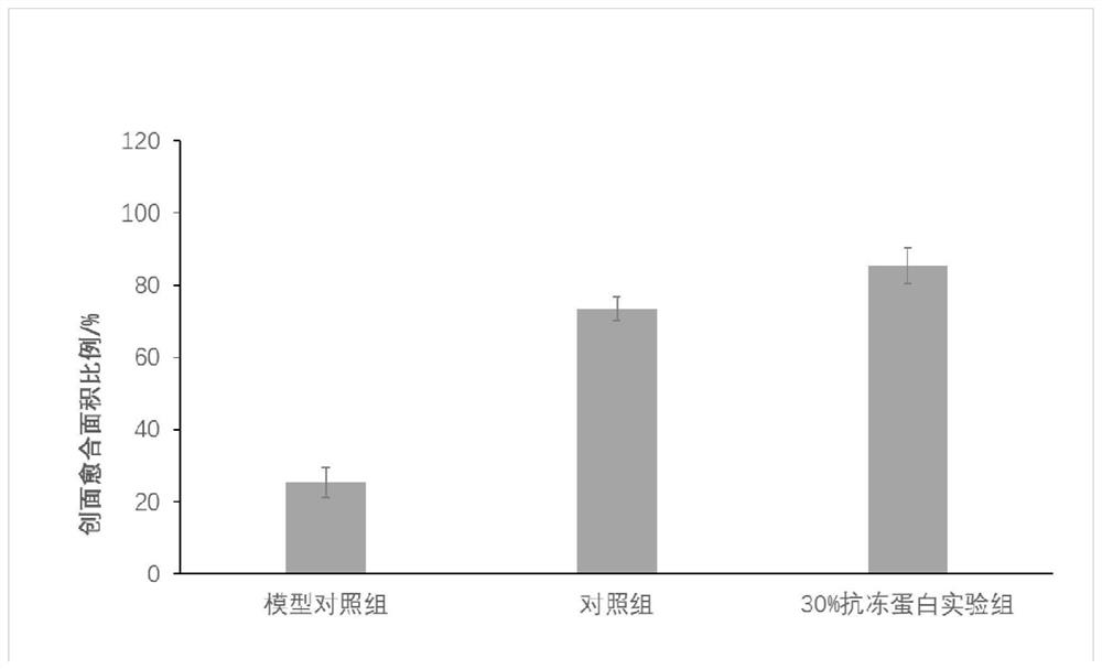 Application of umbilical cord stem cell freeze-dried powder in preparation of medicines and cosmetics