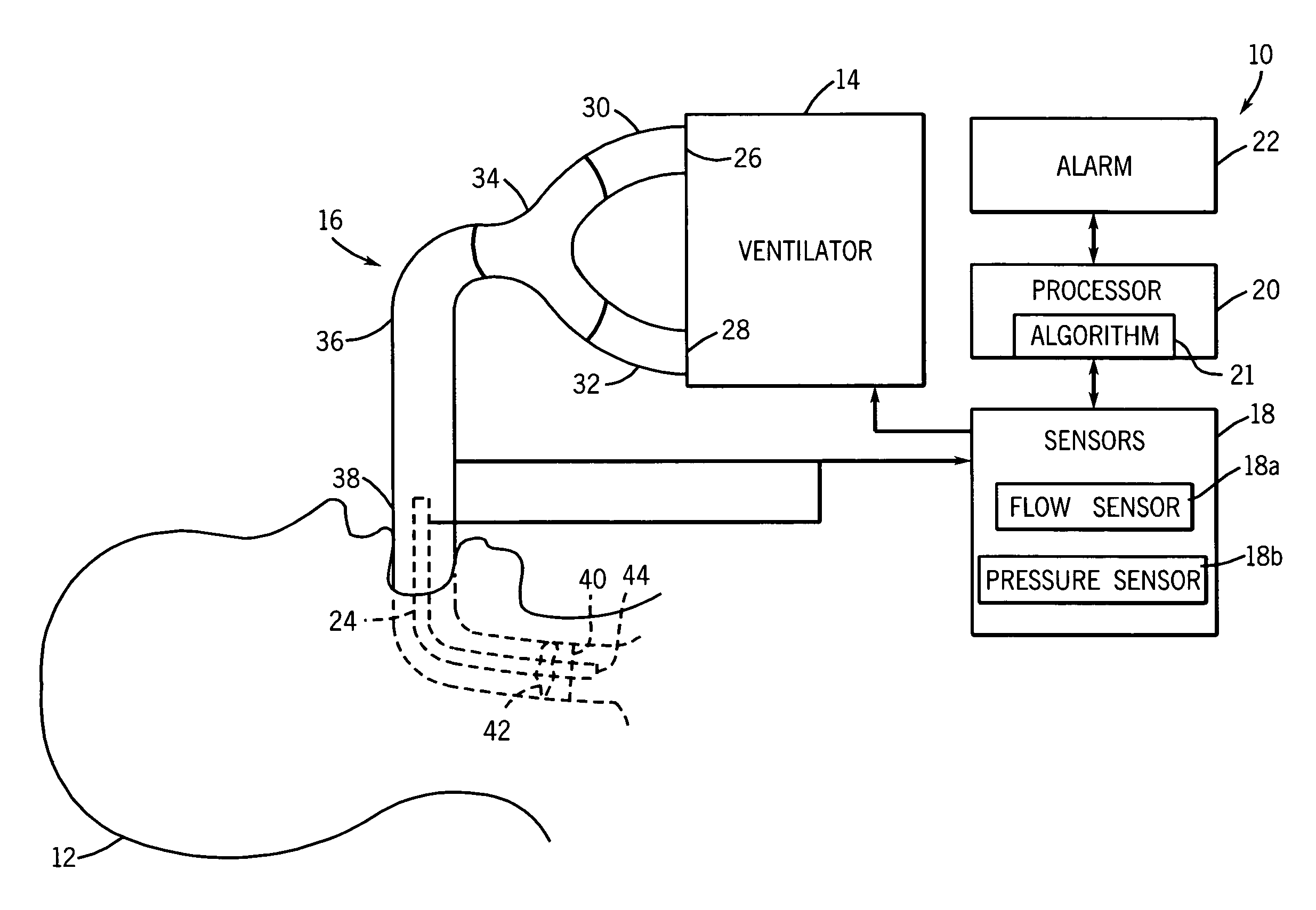 Method and system for detecting breathing tube occlusion