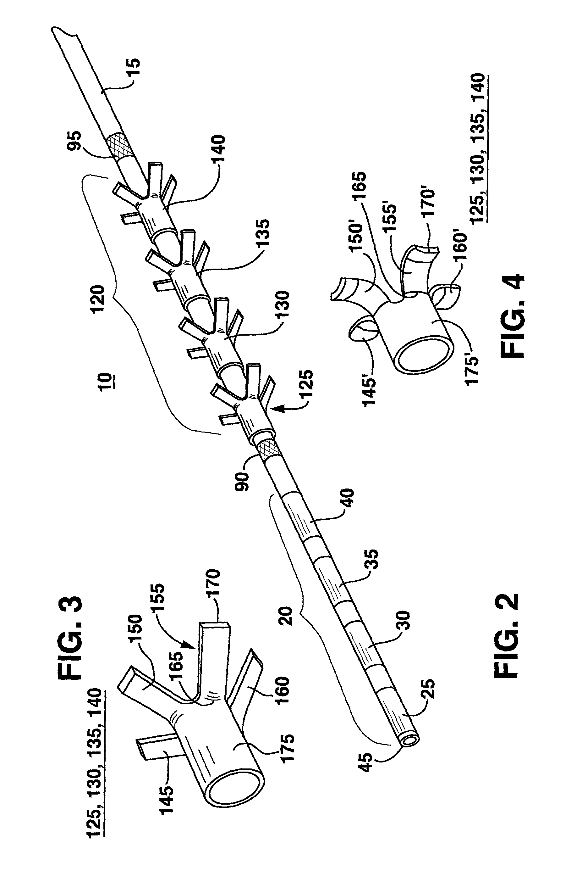 Implantable medical electrical stimulation lead fixation method and apparatus