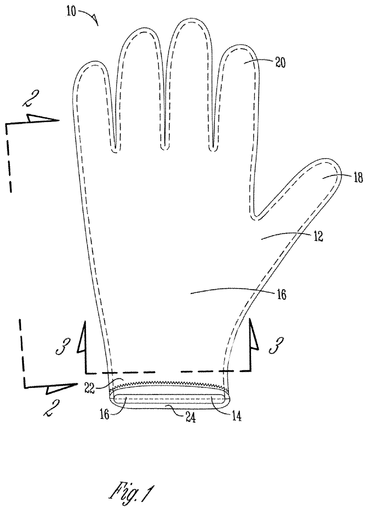 Ambidextrous hand compression therapeutic glove for remediating inflammation, swelling, and pain