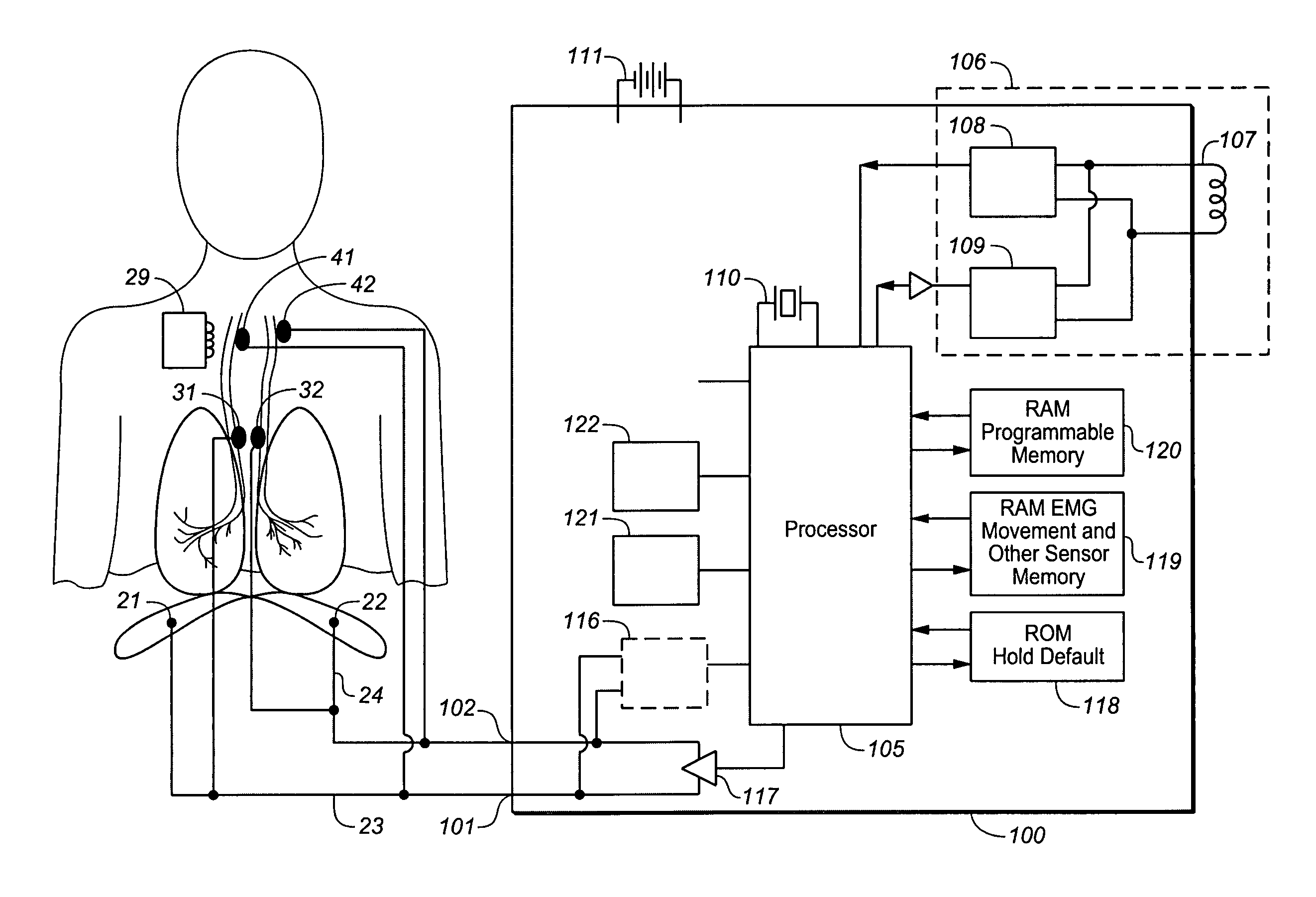 Device and method for biasing lung volume