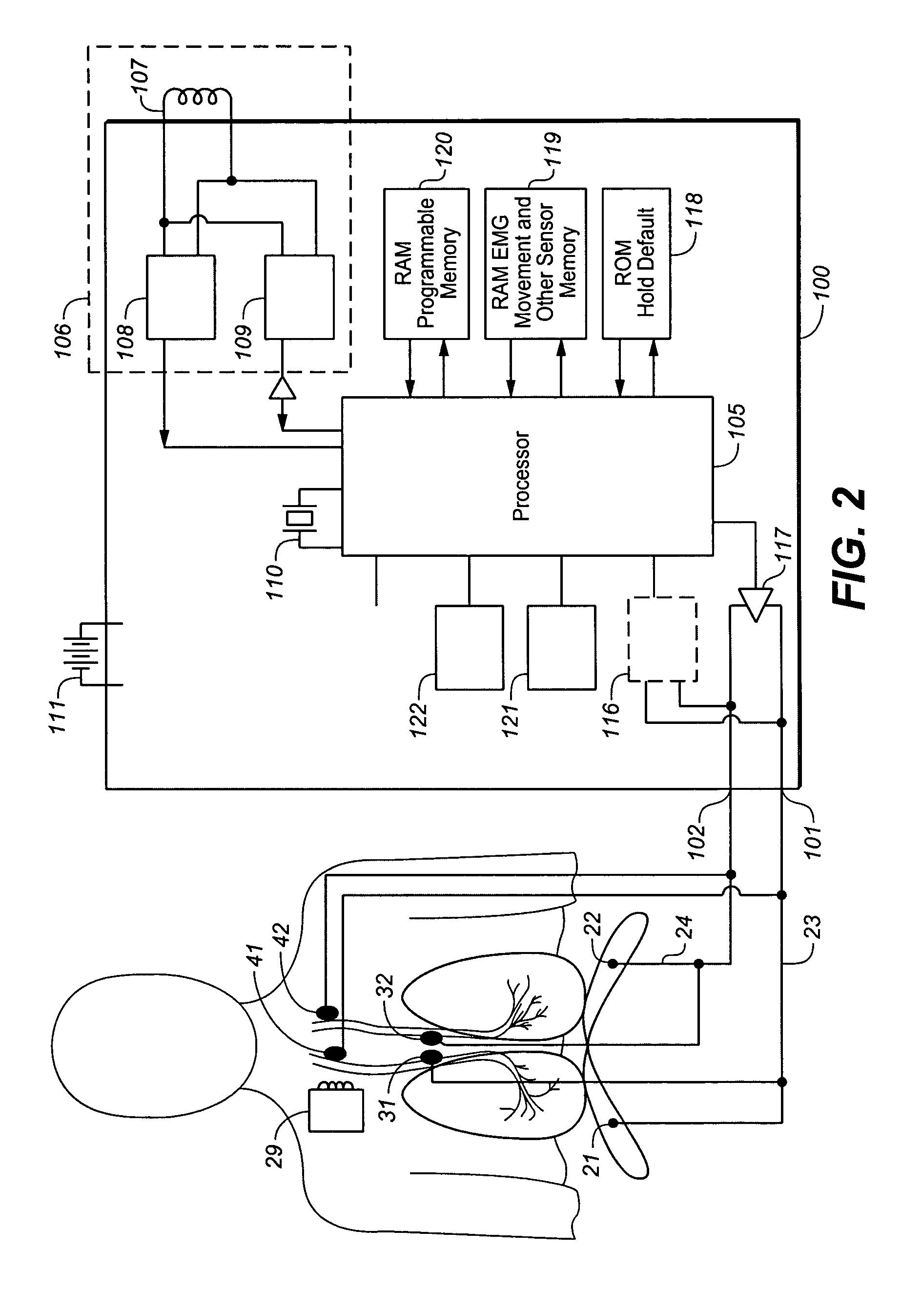 Device and method for biasing lung volume