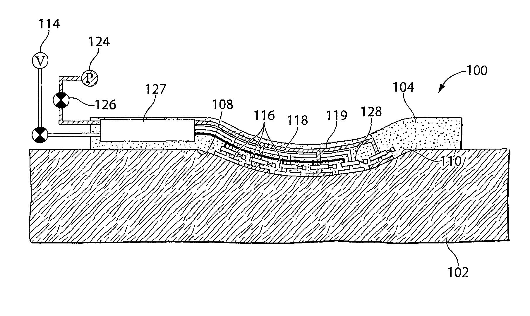 Wound healing device