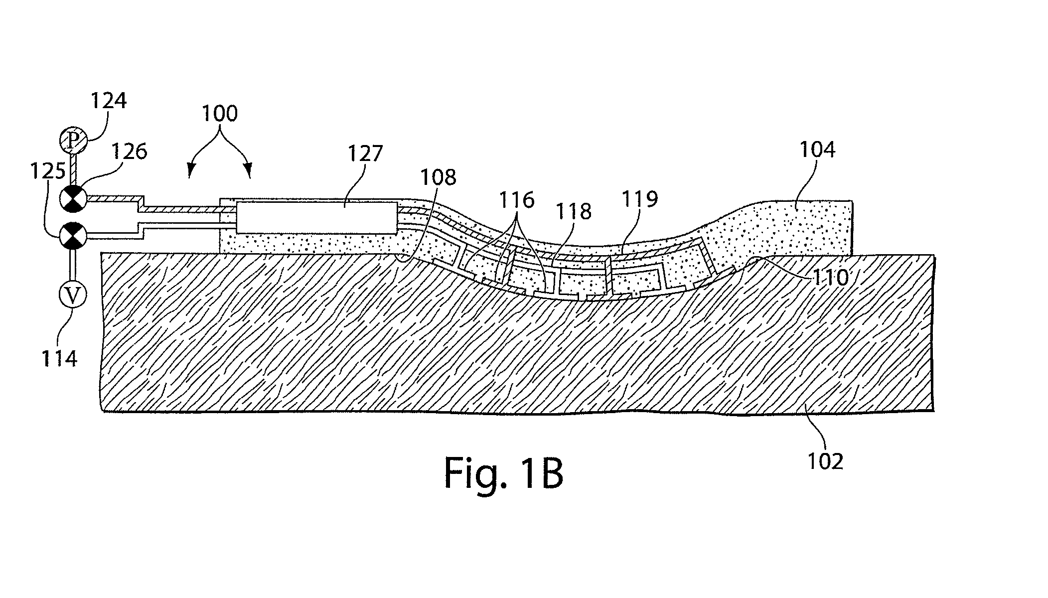 Wound healing device