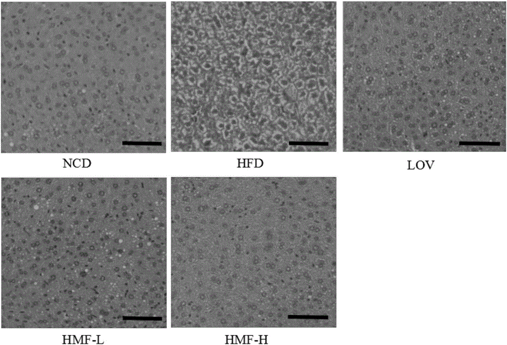 Polymethoxylated flavonoids for preventing or treating non-alcoholic fatty liver diseases, composition and medicine preparation thereof