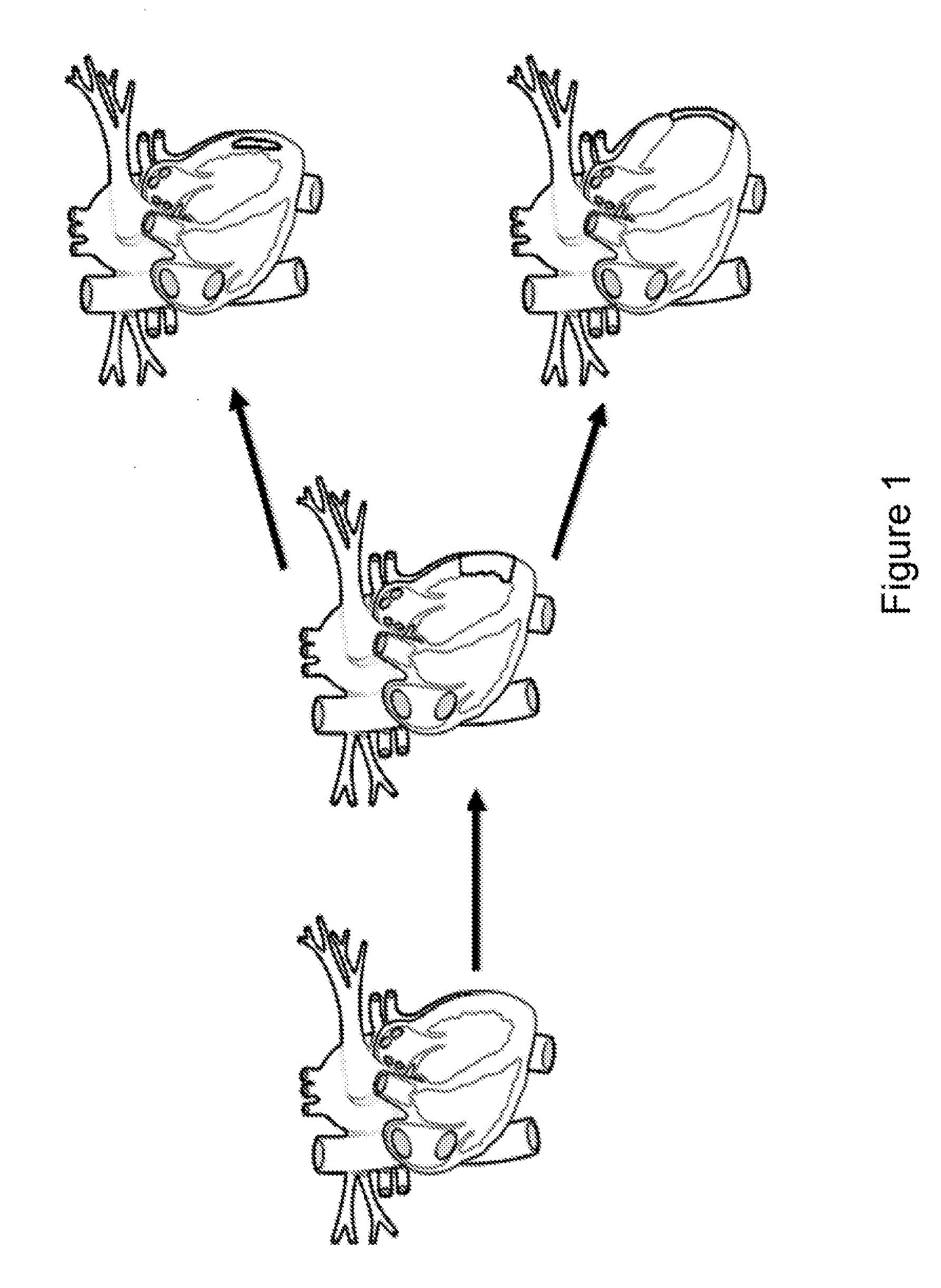 Compositions and Methods for Tissue Repair with Extracellular Matrices