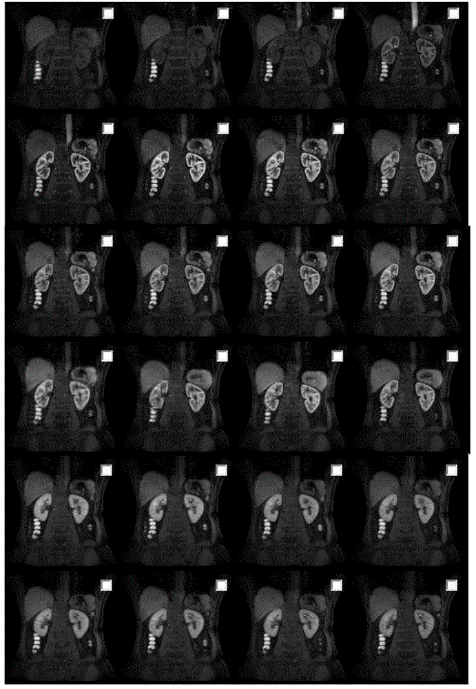 A method for segmenting renal vascular compartments based on medical images