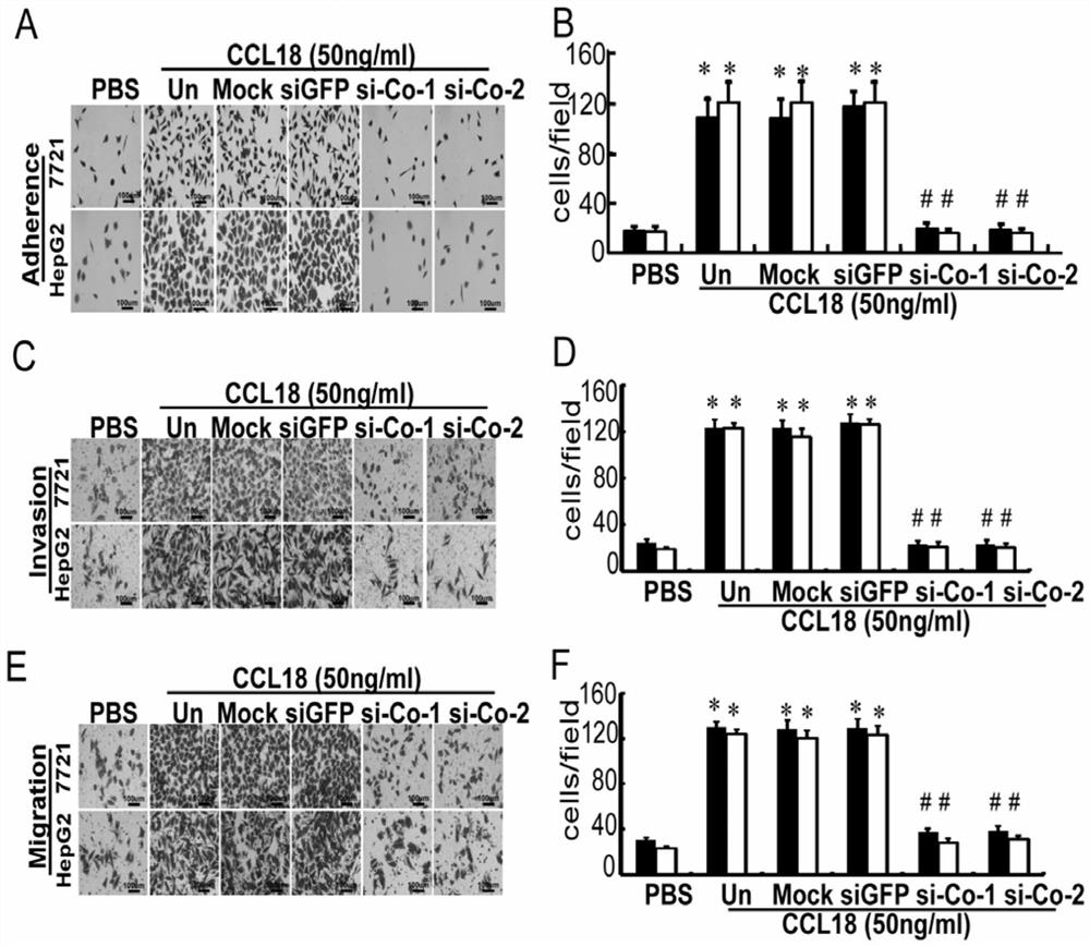 A kind of siRNA of silencing type IV collagen expression and its application