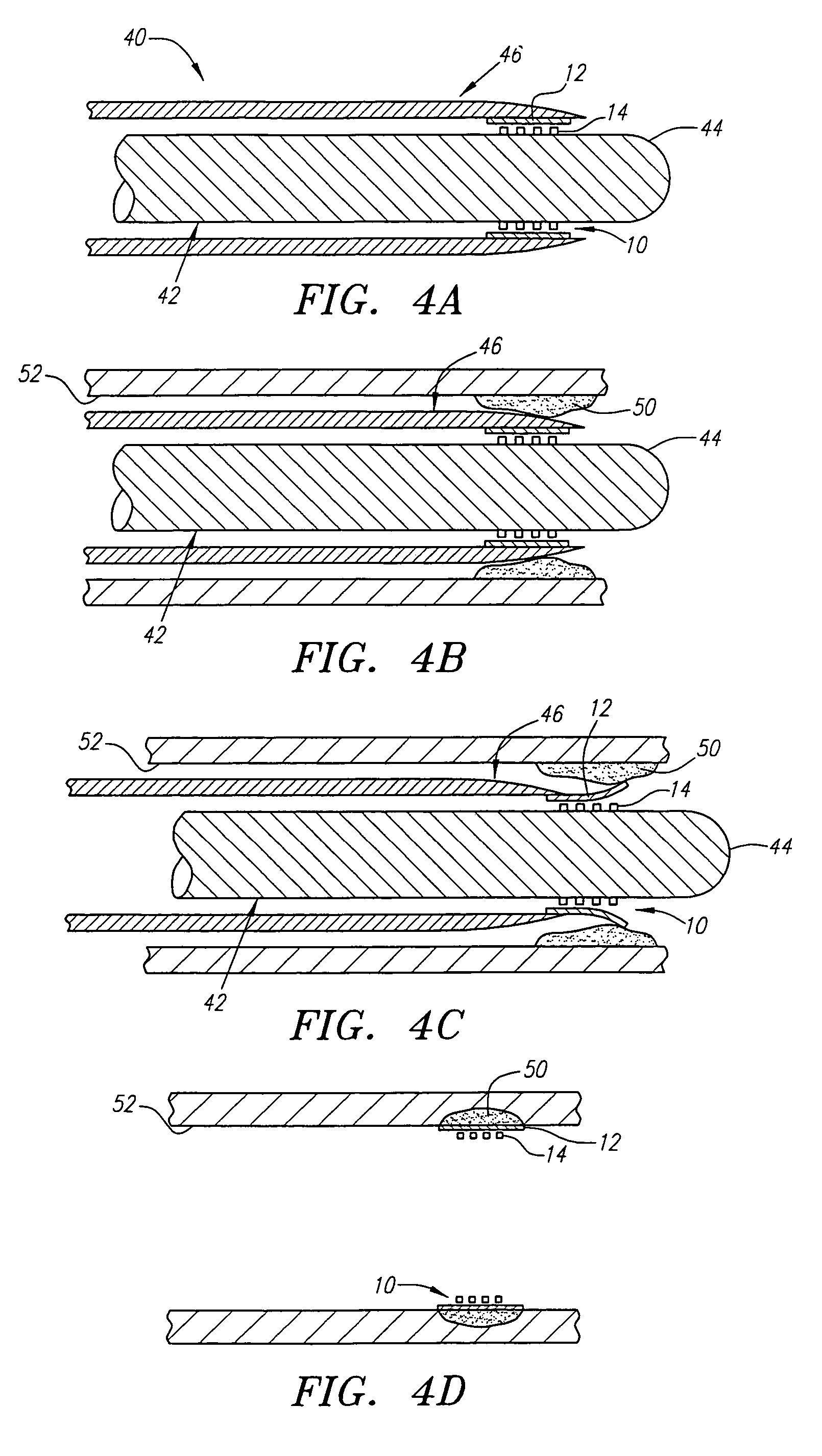 Micro-porous mesh stent with hybrid structure