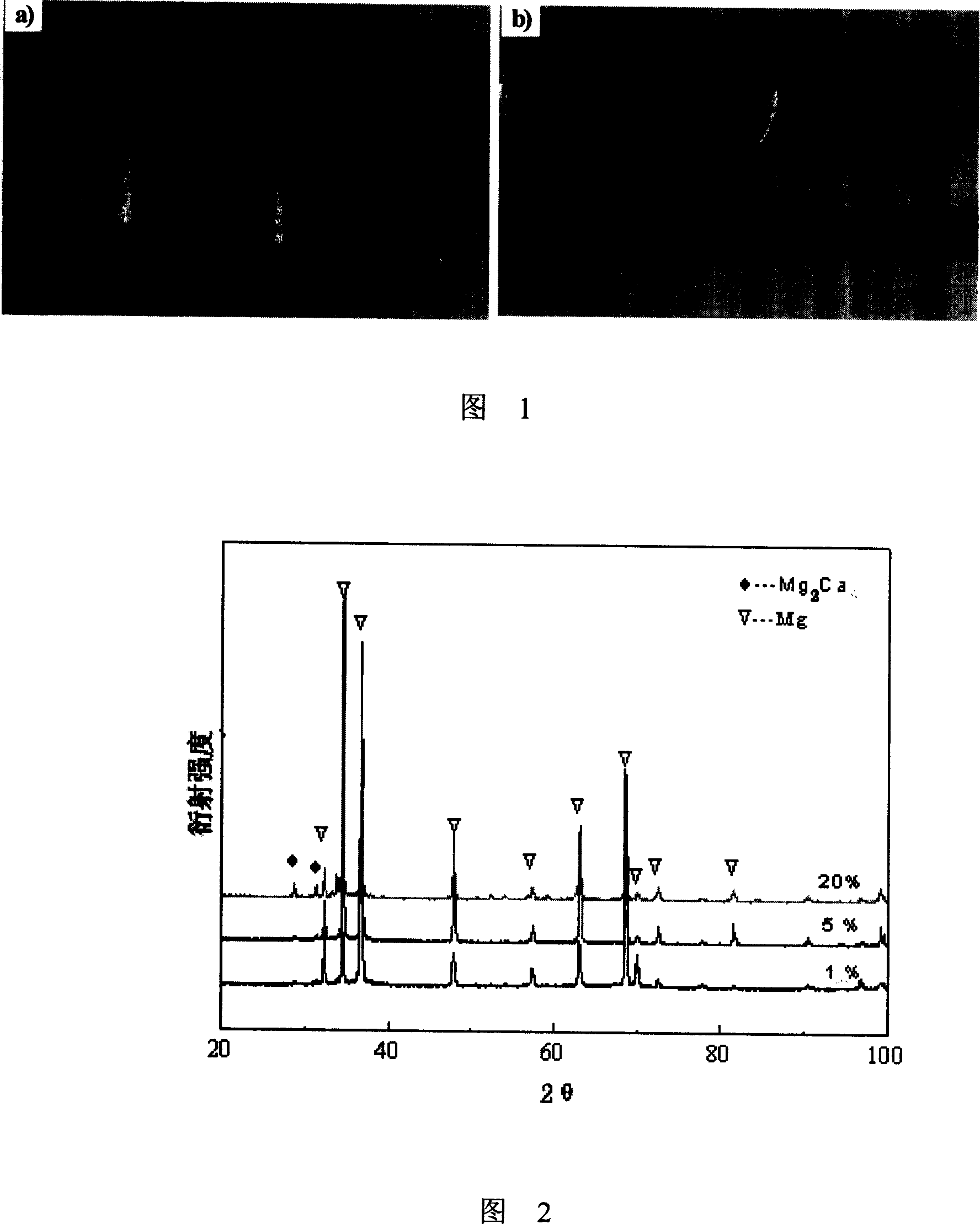 Medical implantation material capable of by degraded by body fluid and its preparing process