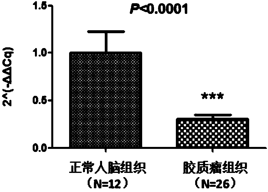 Glioma prognostic marker hsa_circ_0125365 and application