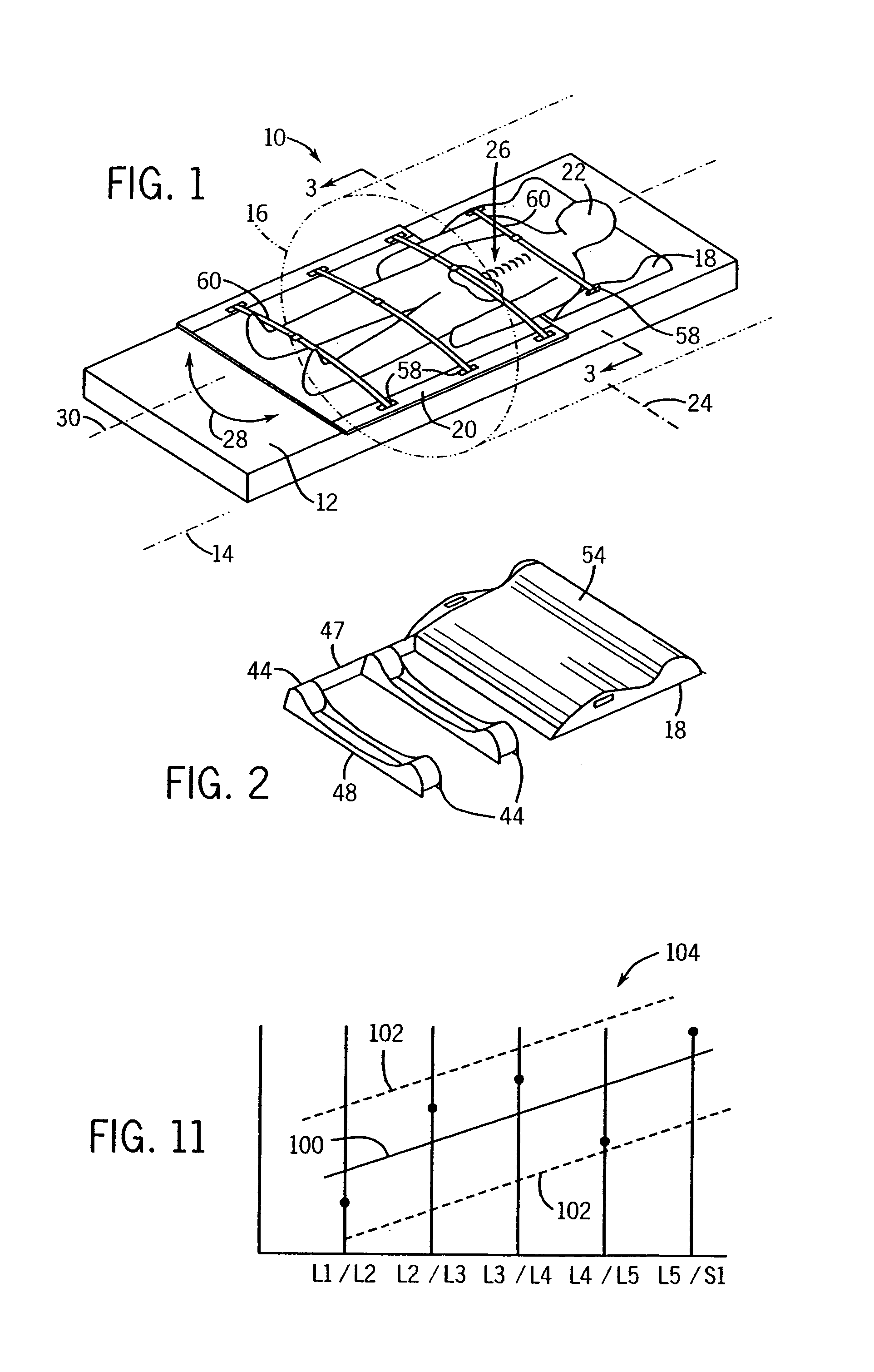 Patient support and method for studies of lumbar vertebra rotation