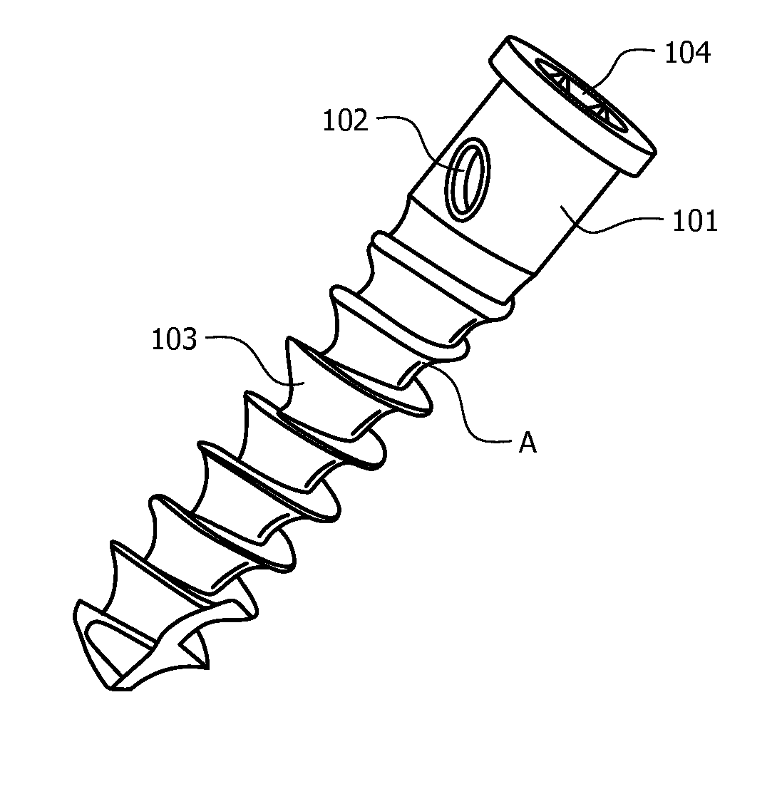 Universal anchor for attaching objects to bone tissue