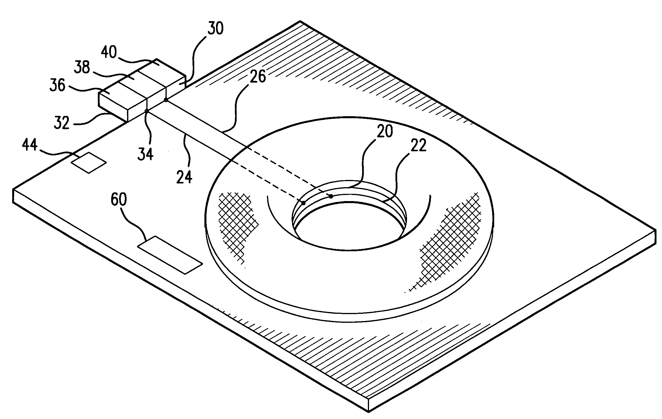 Colostomy alert device and method