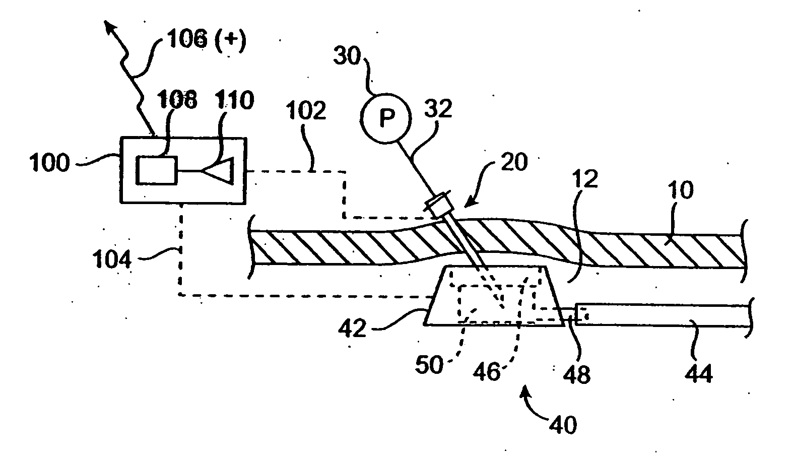 Vascular access port with needle detector