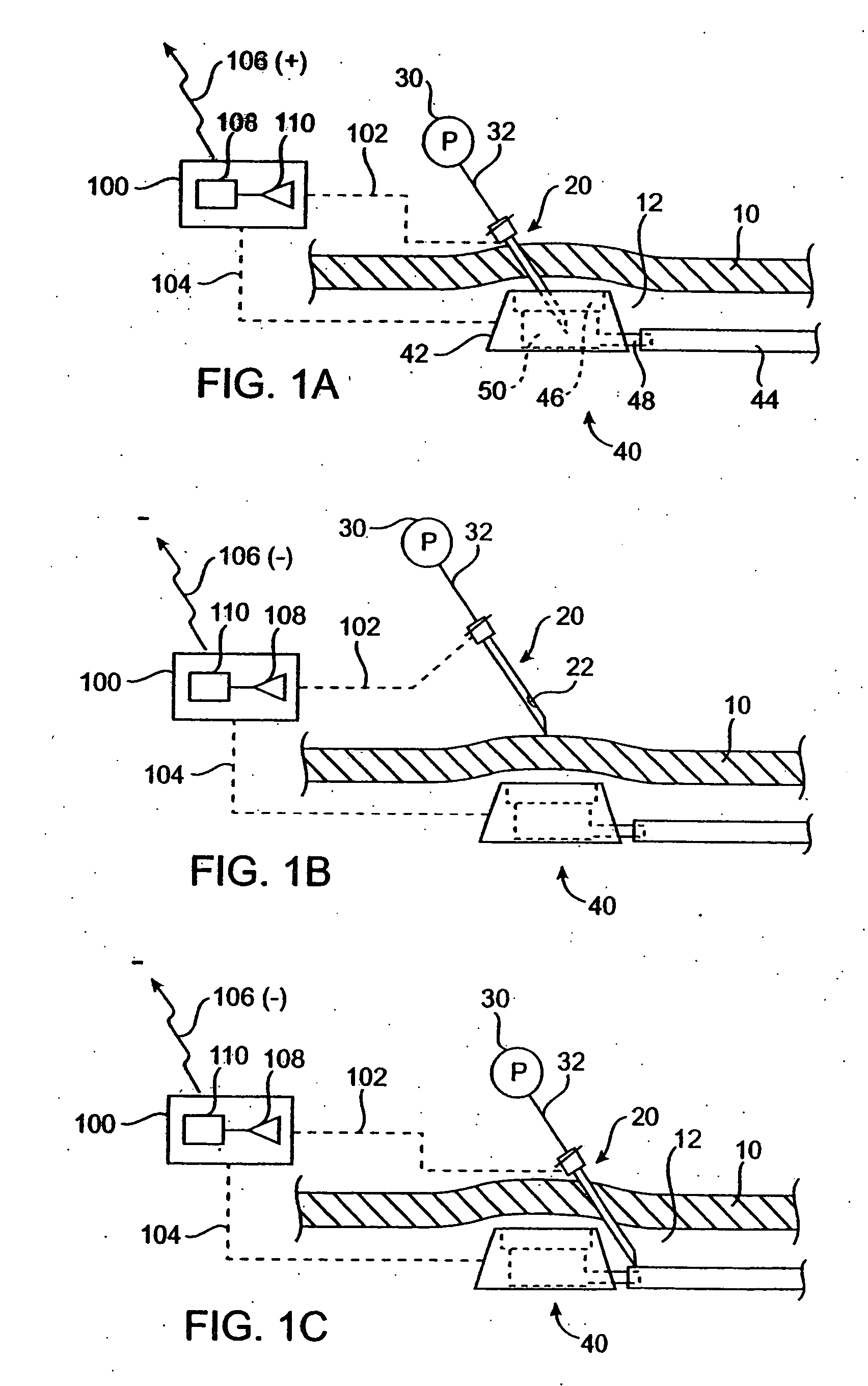 Vascular access port with needle detector