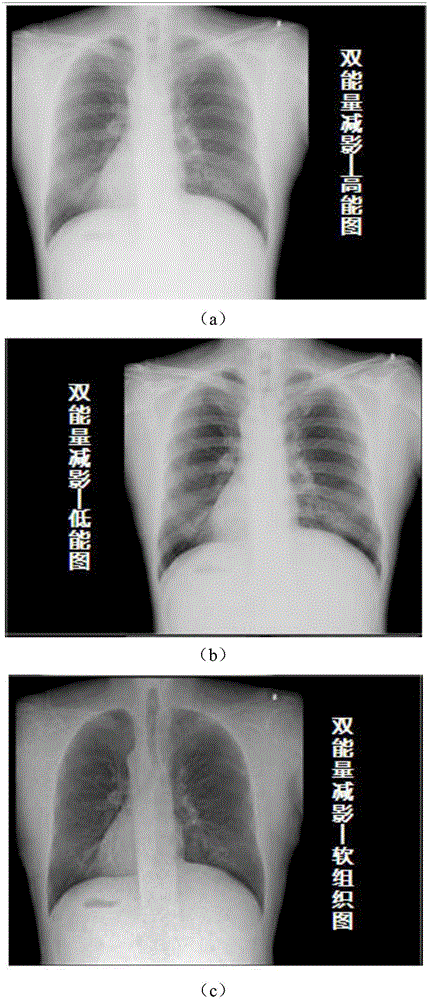 DR machine-based dual energy subtraction method