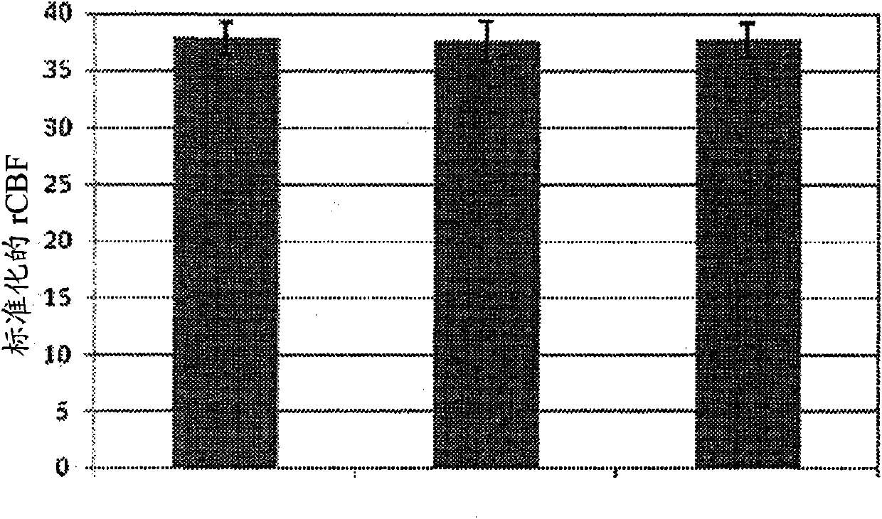 Methods for treating disorders using nmda nr2b-subtype selective antagonist