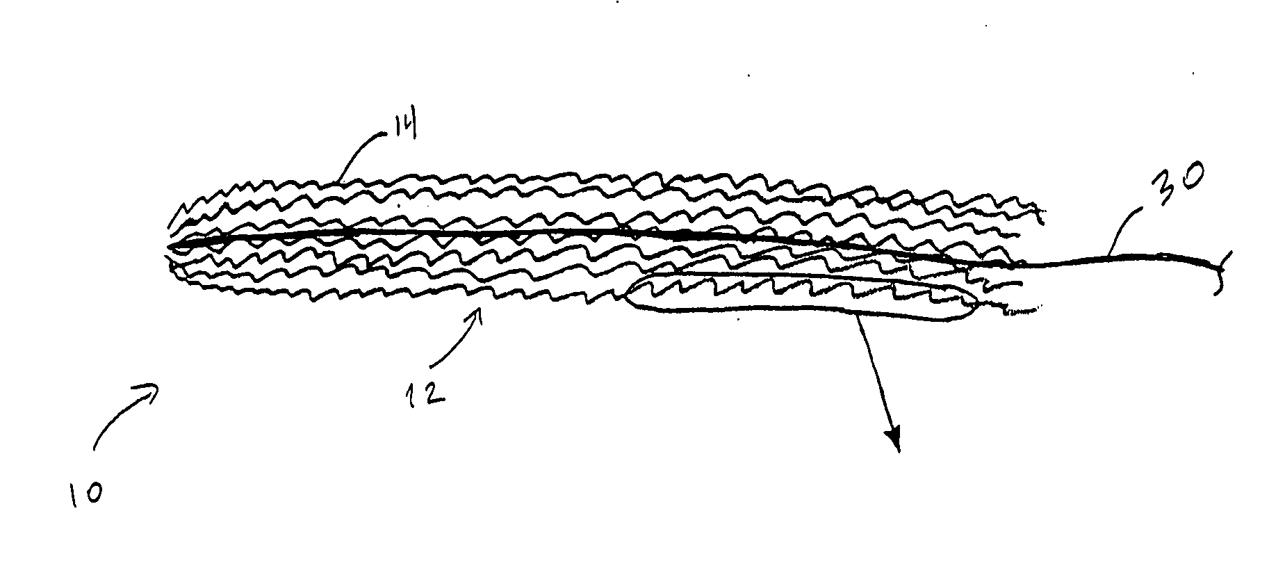 Occlusive implant and methods for hollow anatomical structure