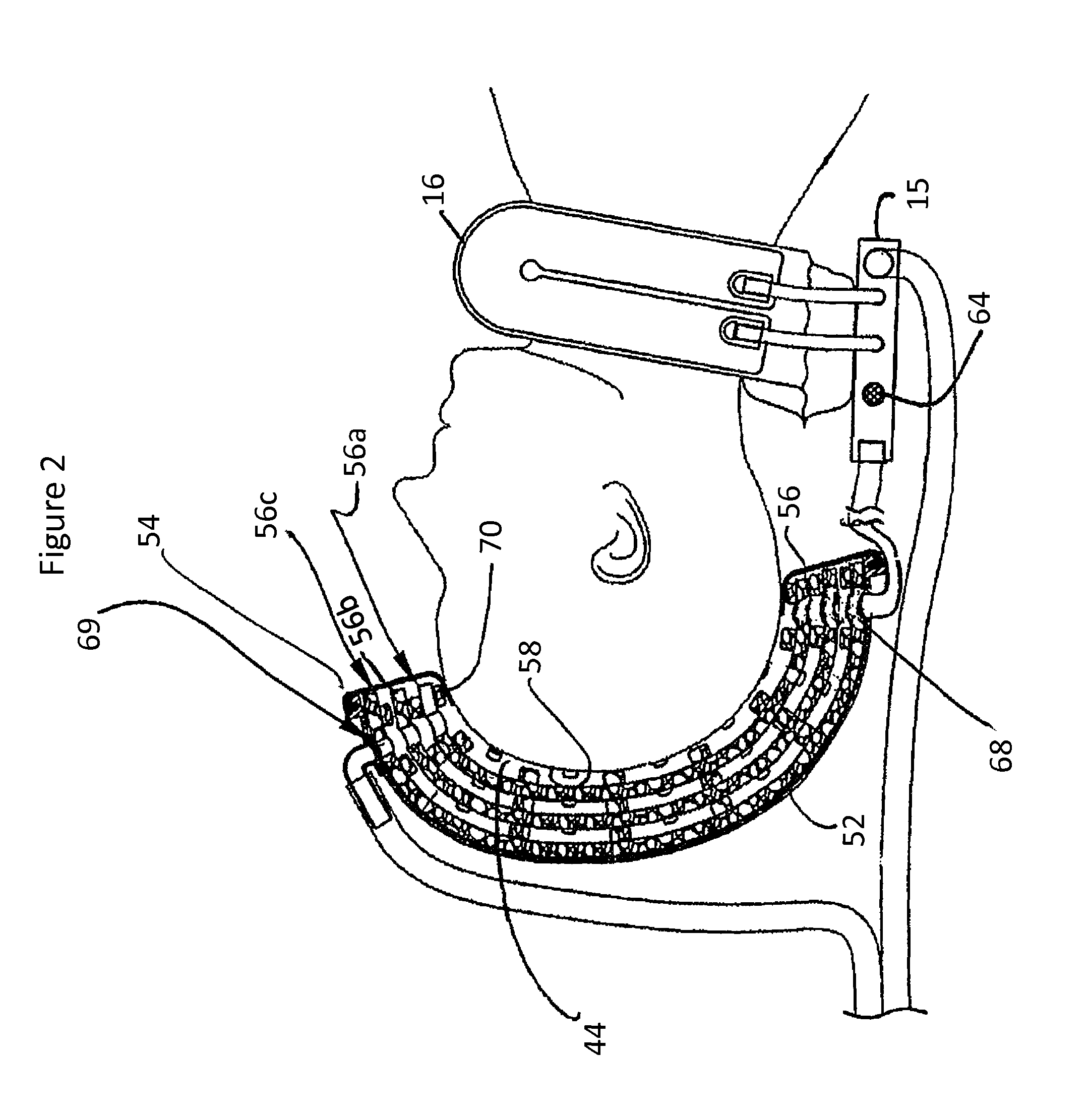 Adjustable thermal cap