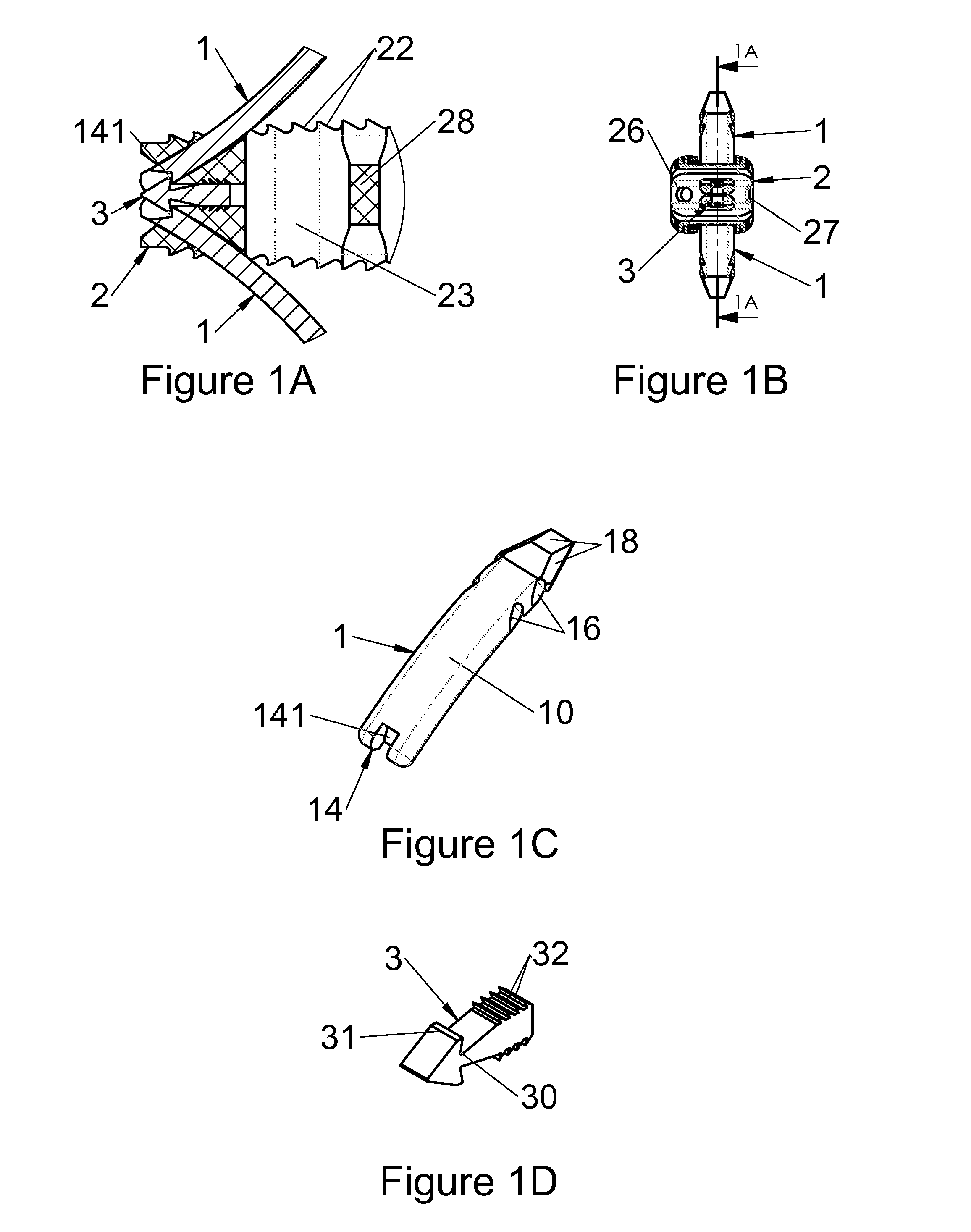 Anchoring device for a spinal implant, spinal implant and implantation instrumentation