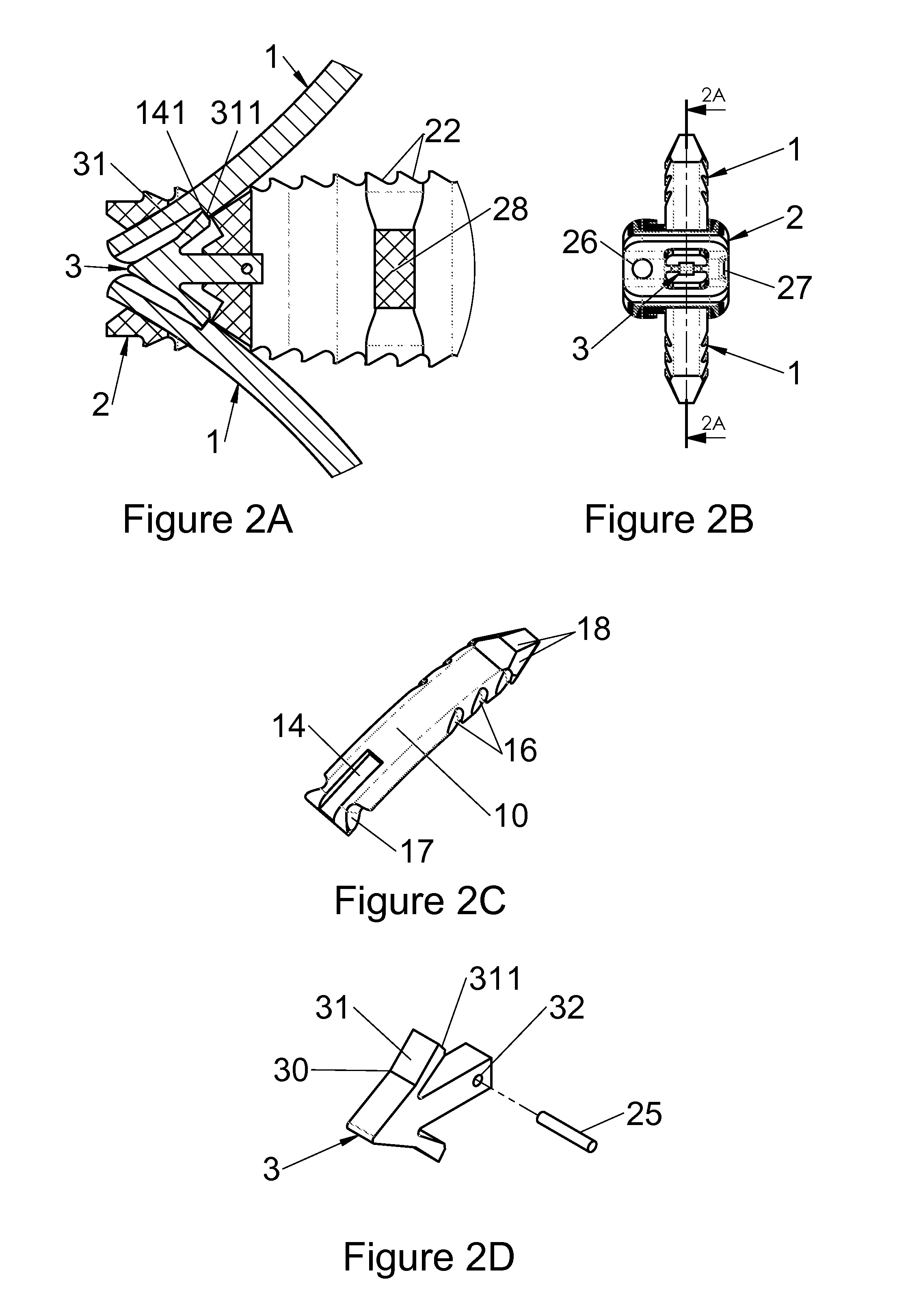 Anchoring device for a spinal implant, spinal implant and implantation instrumentation