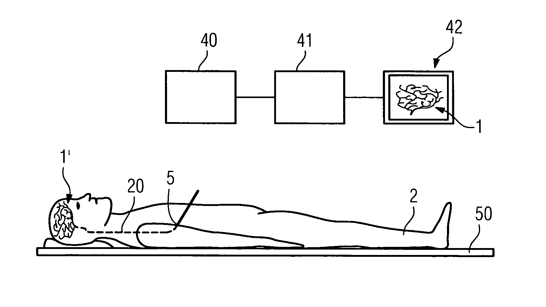 Method for displaying a hollow space in an object under investigation